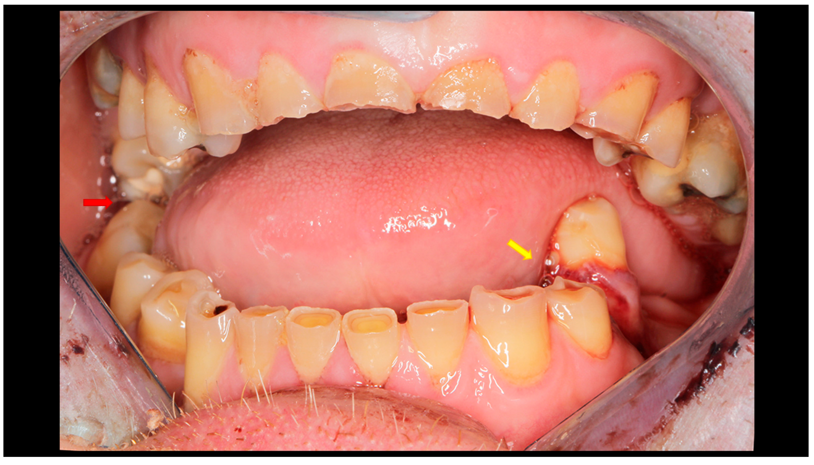 Dentistry 13 00562 g002 Dentistry 13 00562 g002