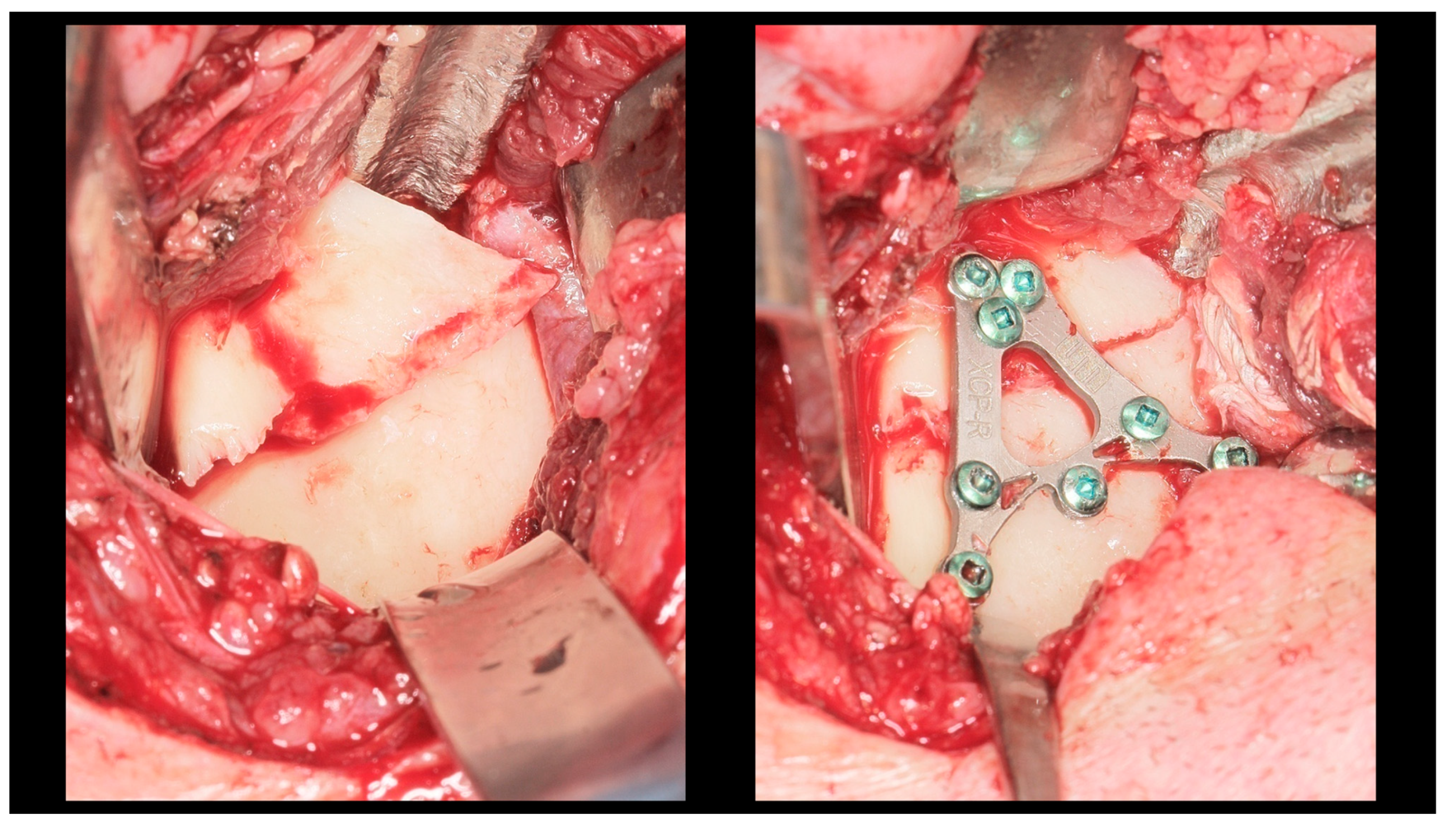 Dentistry 13 00562 g003 Dentistry 13 00562 g003