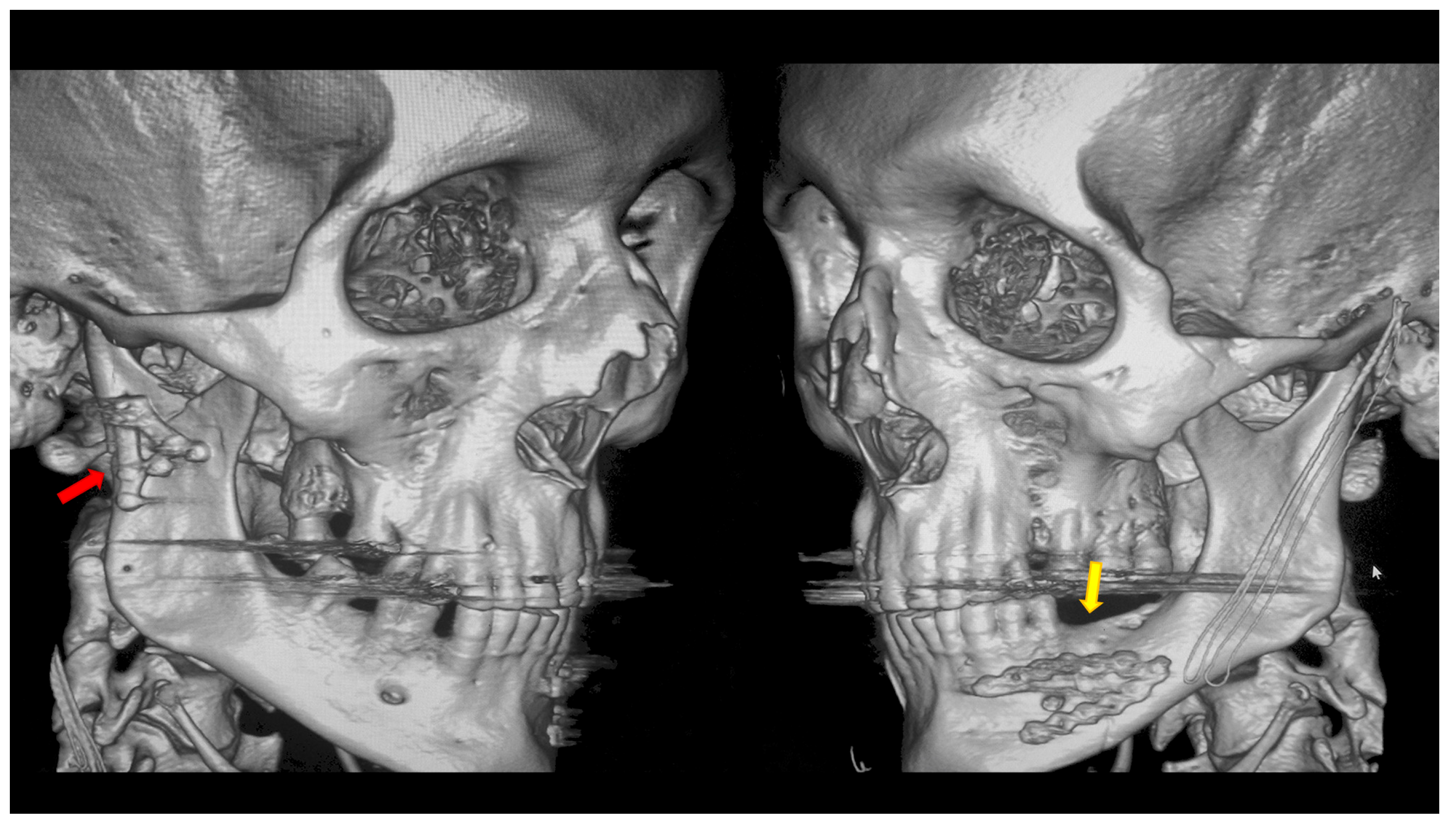 Dentistry 13 00562 g004 Dentistry 13 00562 g004