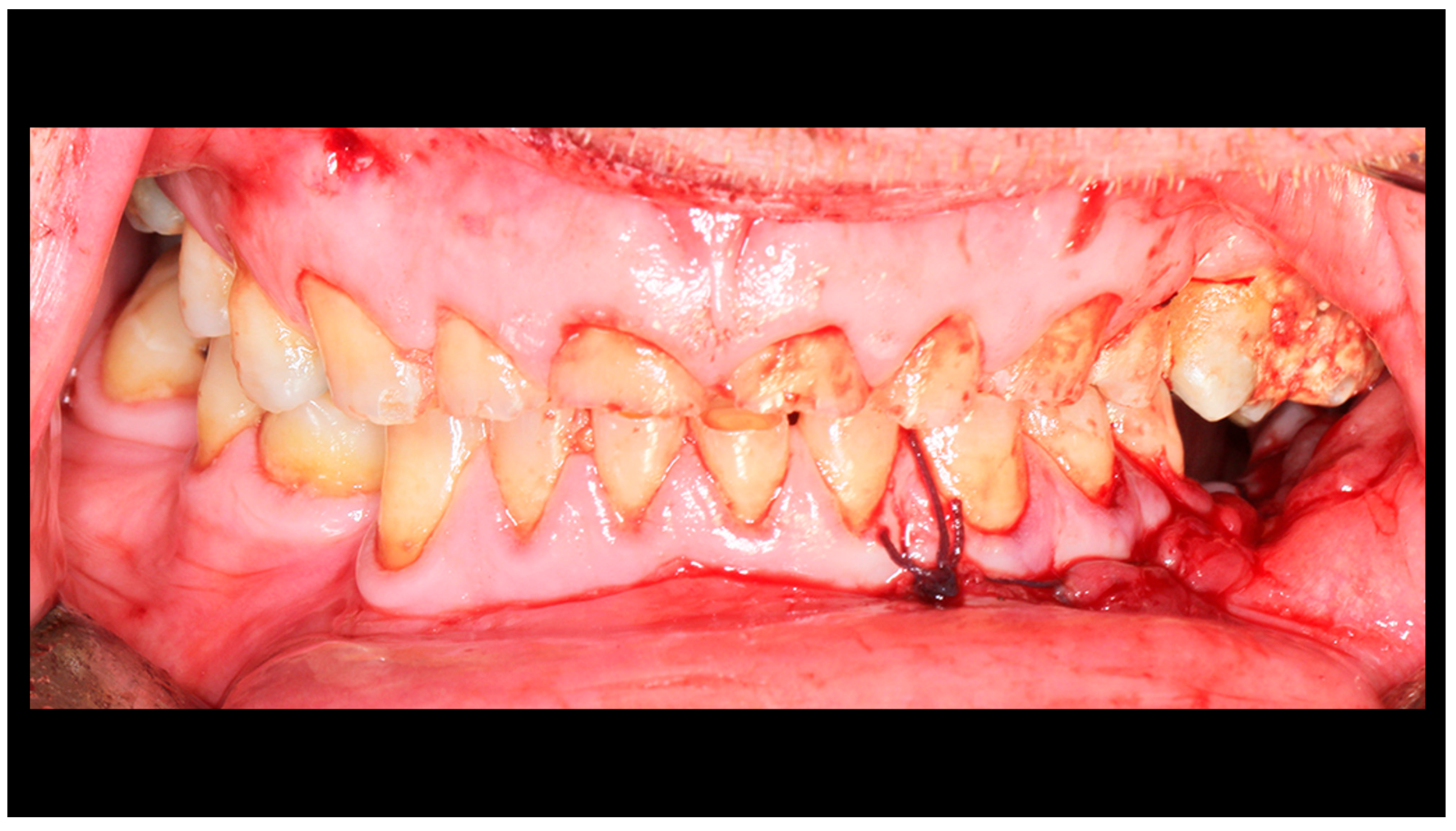 Dentistry 13 00562 g005 Dentistry 13 00562 g005