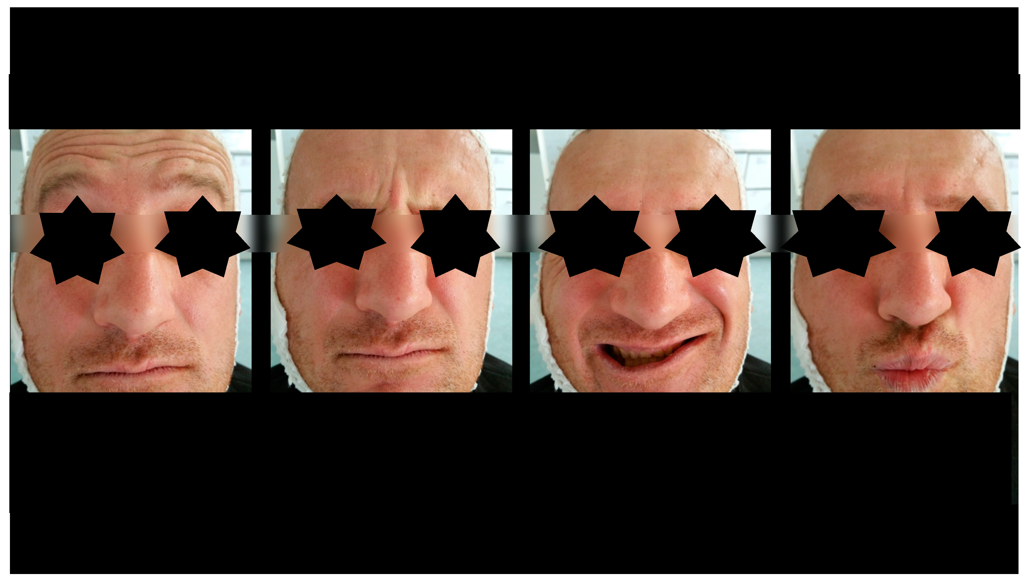 Dentistry 13 00562 g006 Dentistry 13 00562 g006