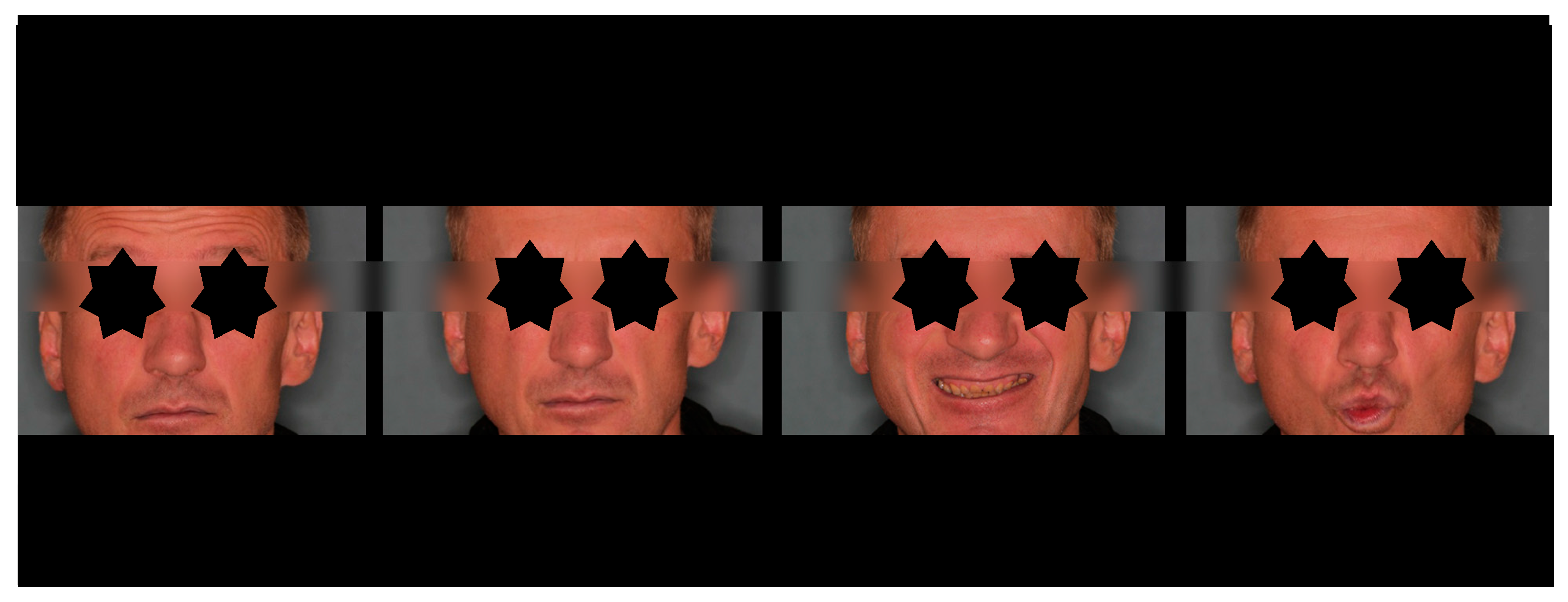 Dentistry 13 00562 g009 Dentistry 13 00562 g009