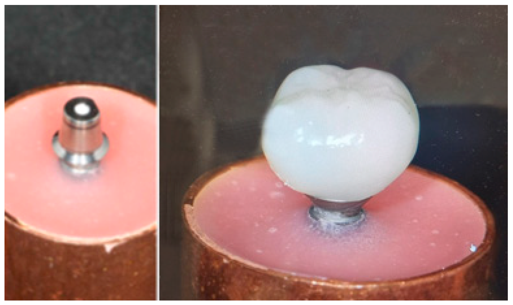 Dentistry 13 00574 g002 Dentistry 13 00574 g002