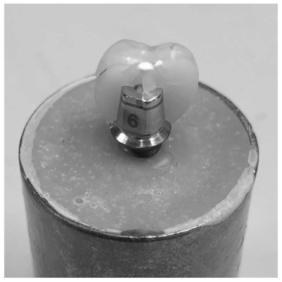 Dentistry 13 00574 g003 Dentistry 13 00574 g003