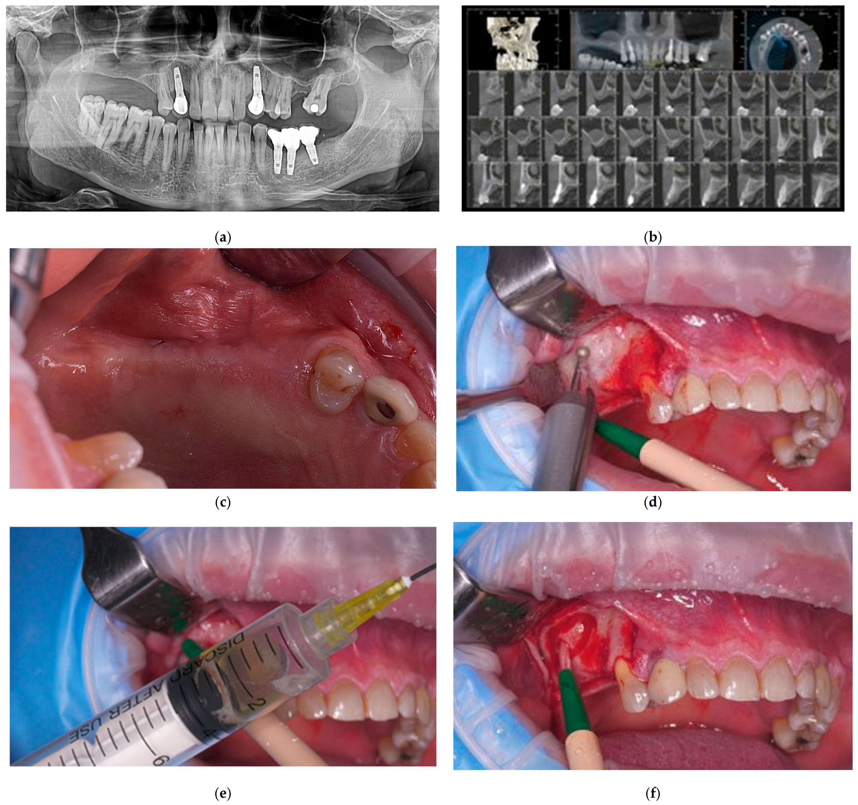 Dentistry 13 00584 g001a Dentistry 13 00584 g001a