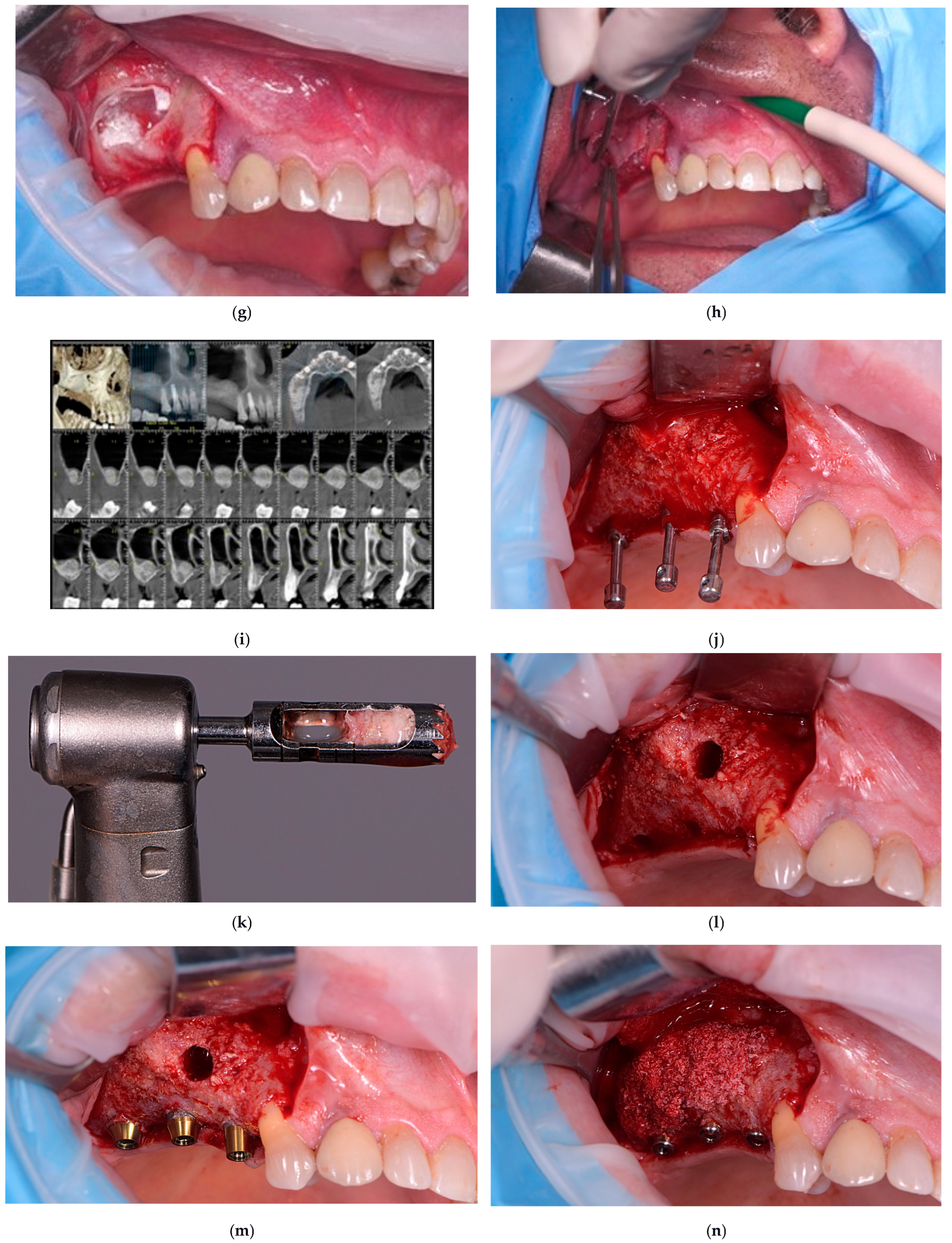 Dentistry 13 00584 g001b Dentistry 13 00584 g001b