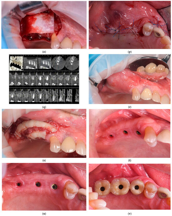 Dentistry 13 00584 g001c Dentistry 13 00584 g001c