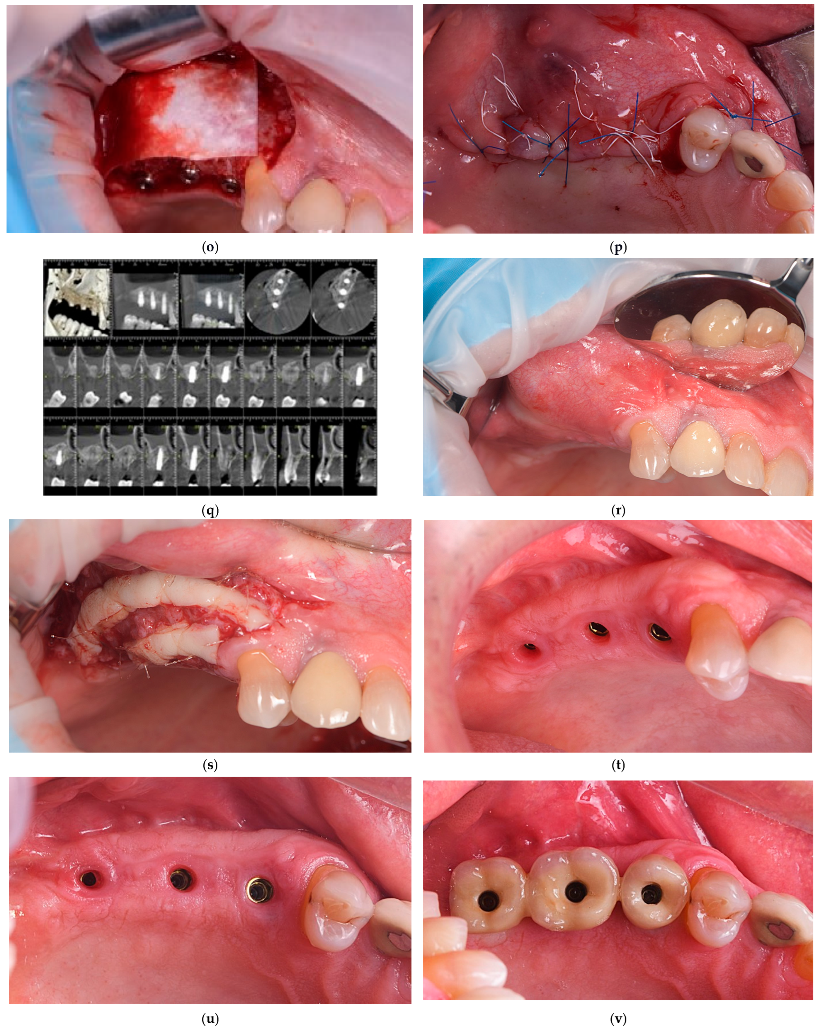 Dentistry 13 00584 g001c Dentistry 13 00584 g001c