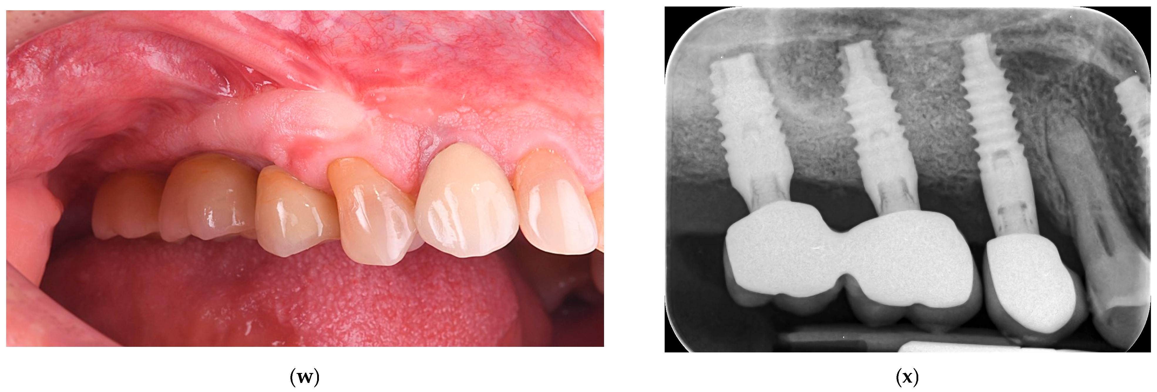 Dentistry 13 00584 g001d Dentistry 13 00584 g001d