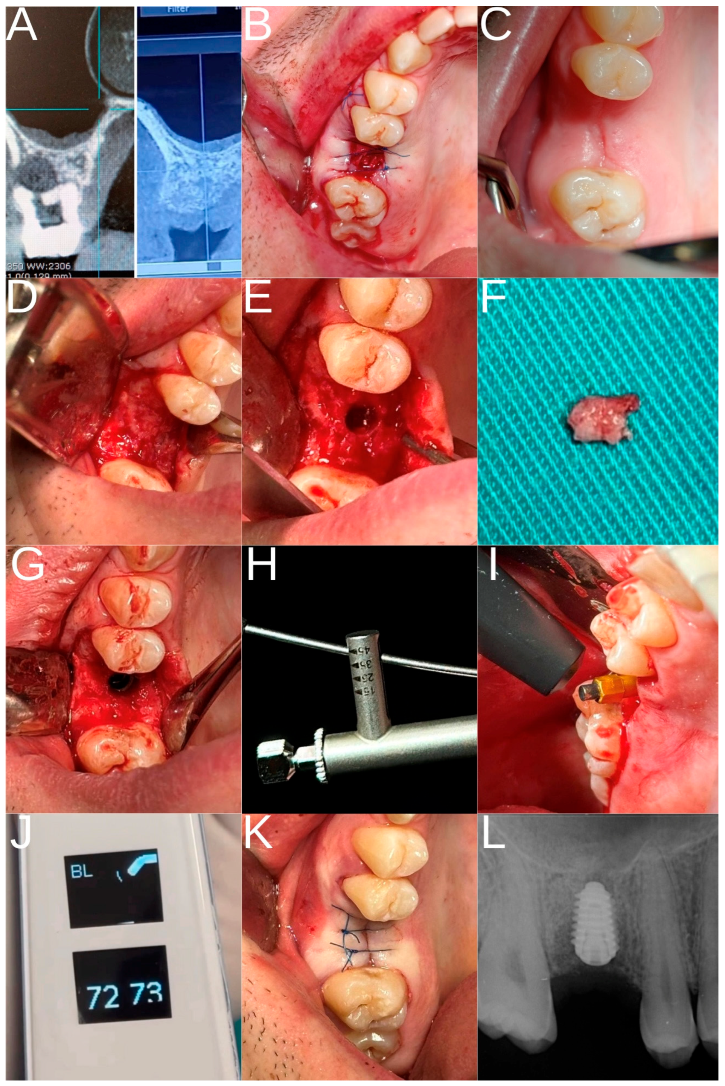 Dentistry 13 00585 g002