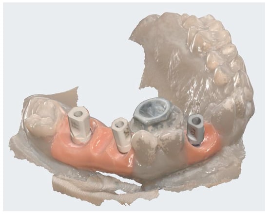 Dentistry 13 00586 g003