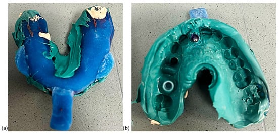 Dentistry 13 00586 g004