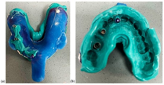 Dentistry 13 00586 g005