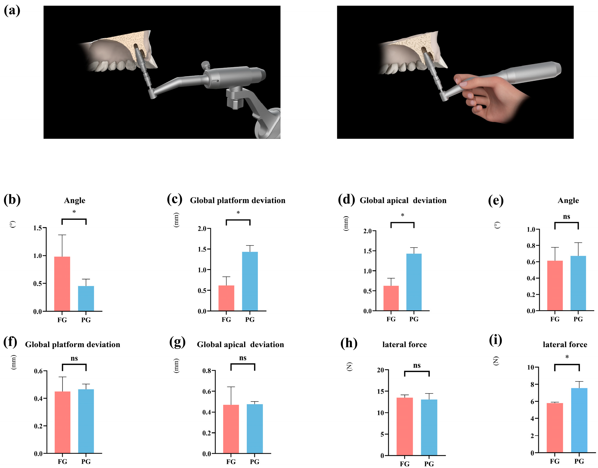 Dentistry 13 00592 g005