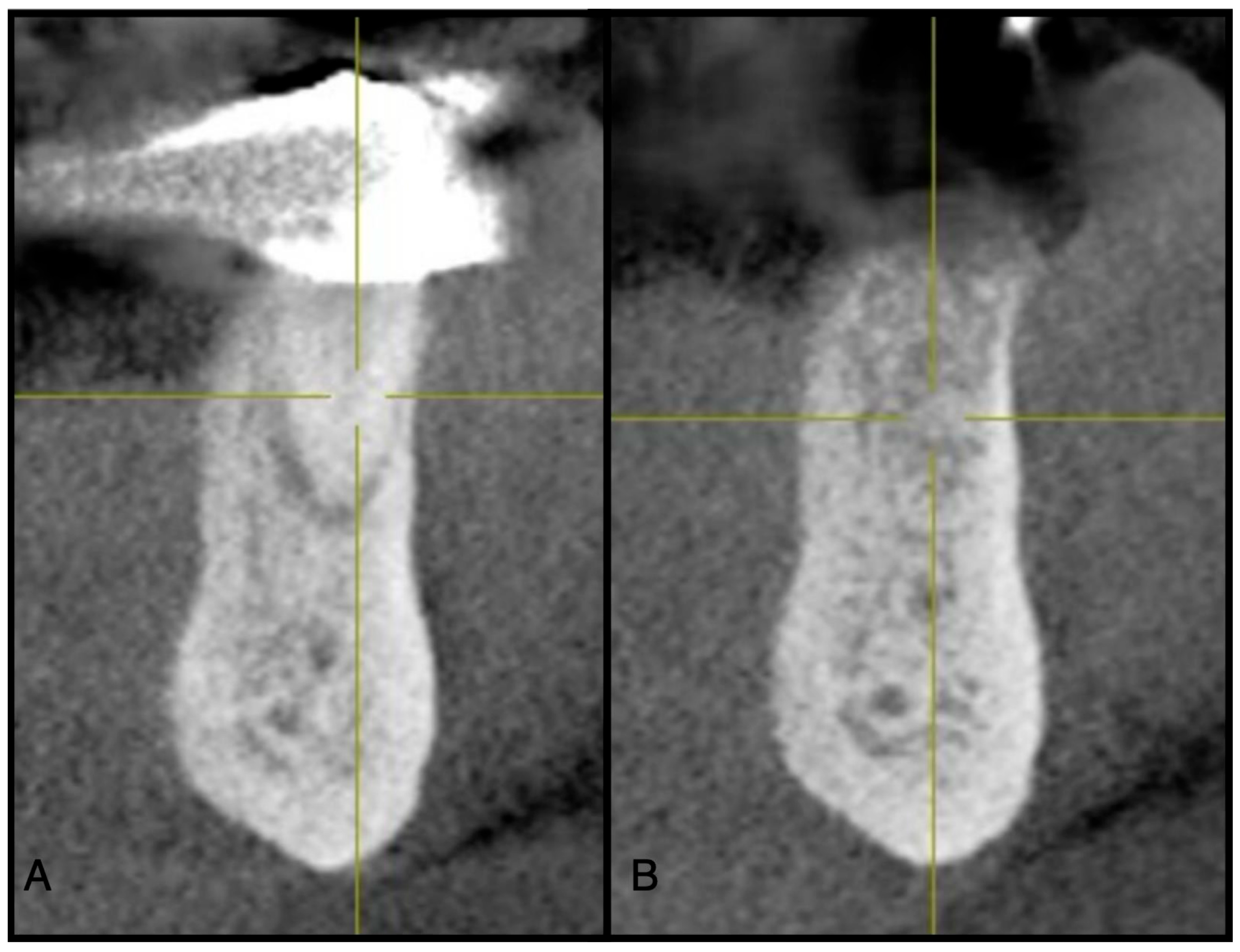 Dentistry 13 00604 g004