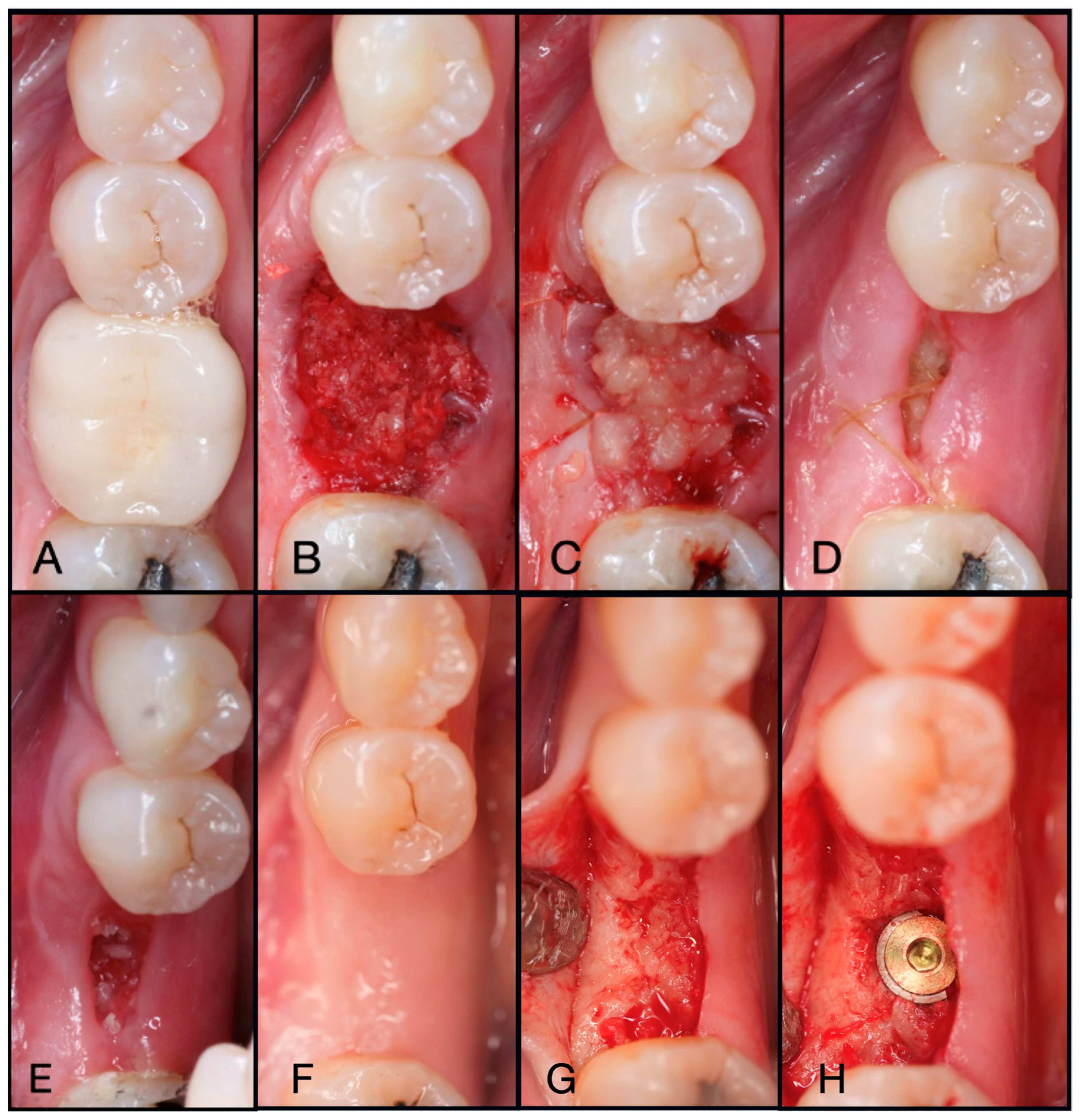 Dentistry 13 00604 g006