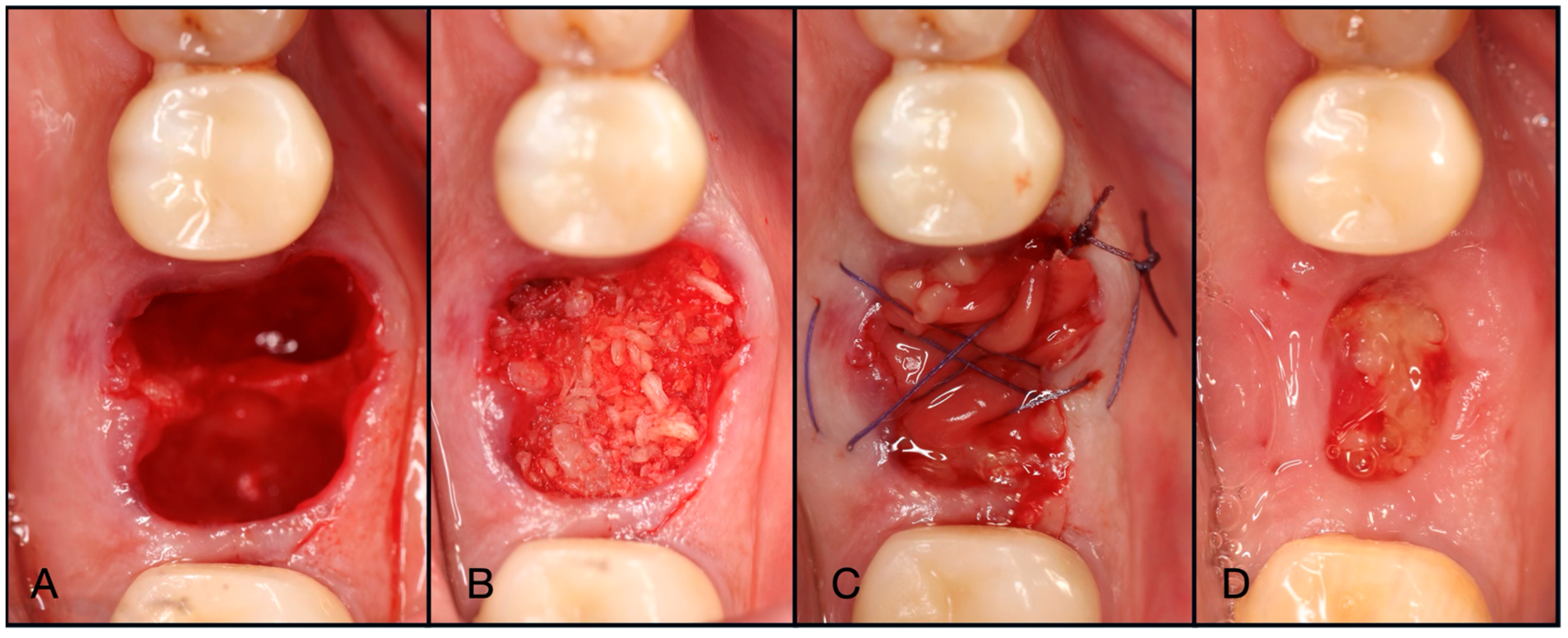 Dentistry 13 00604 g008