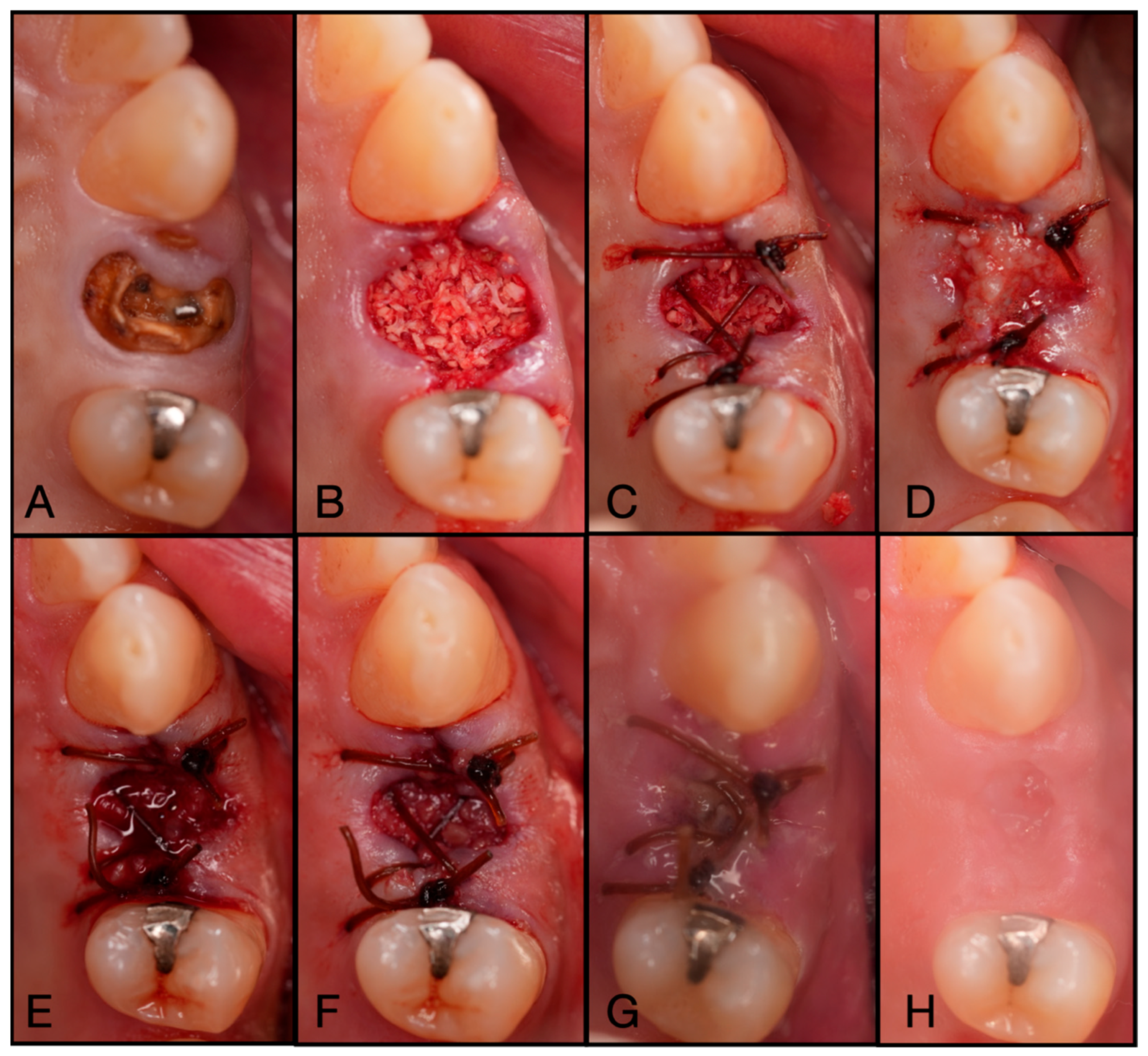 Dentistry 13 00604 g010