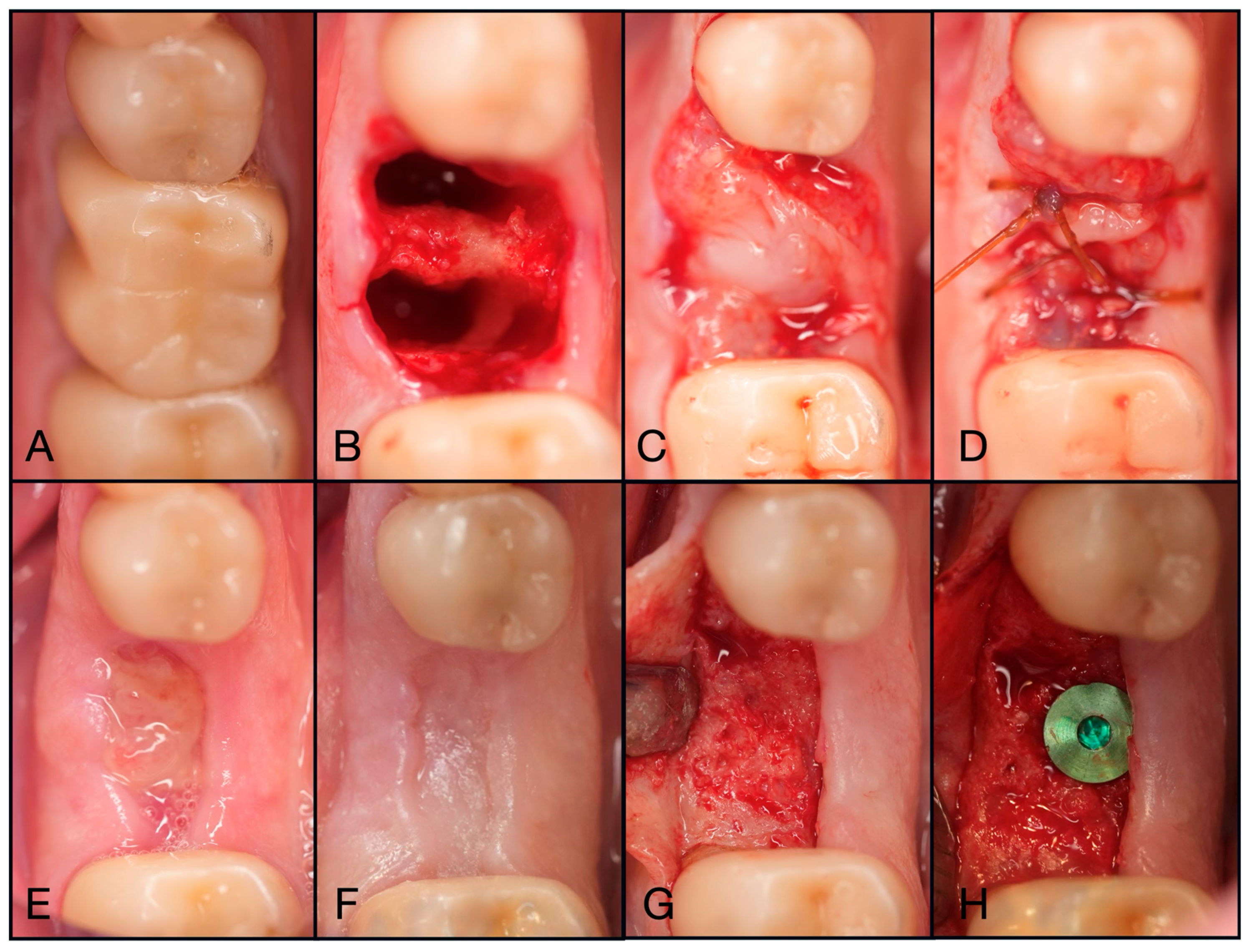 Dentistry 13 00604 g011