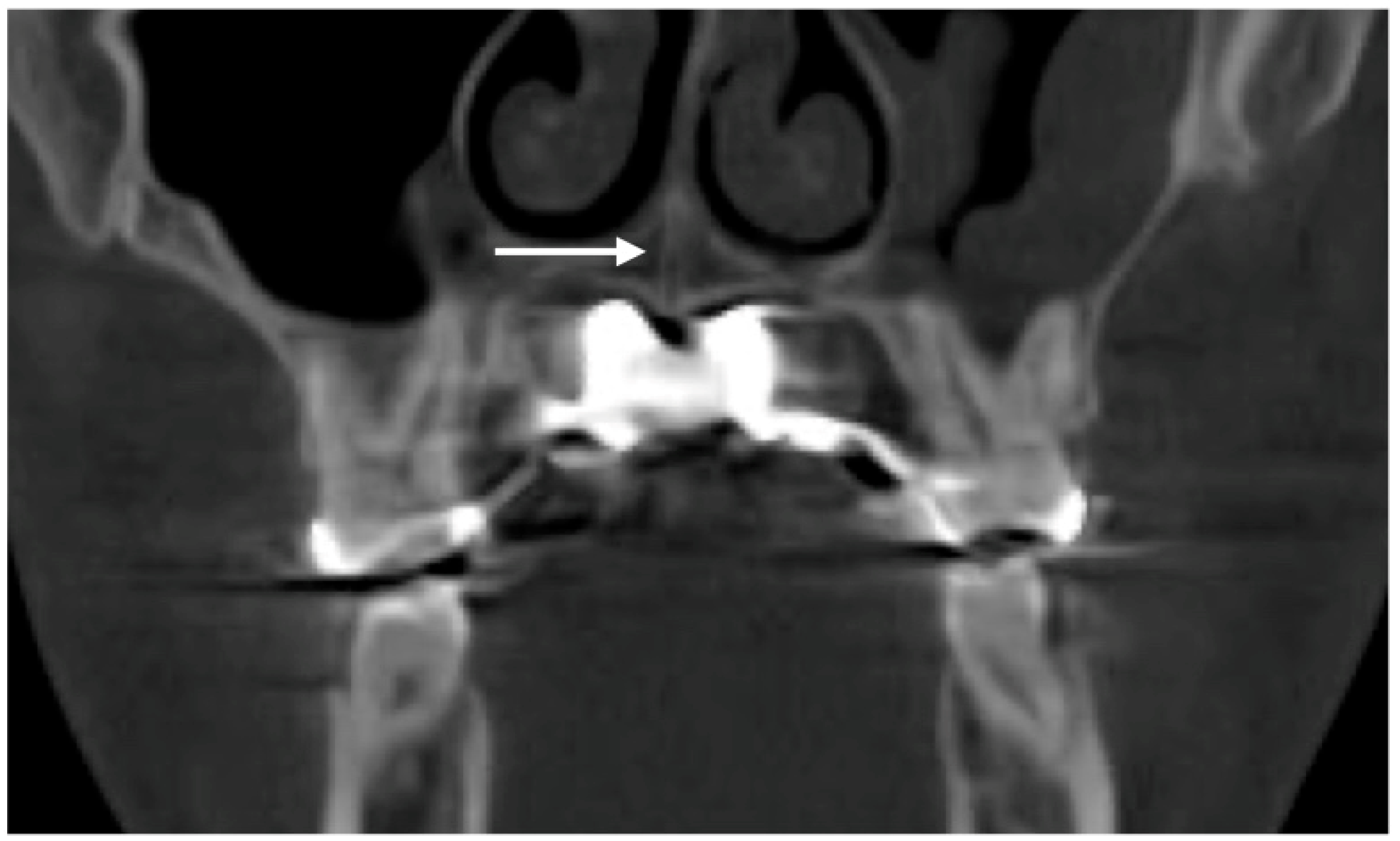 Dentistry 14 00024 g002 Dentistry 14 00024 g002