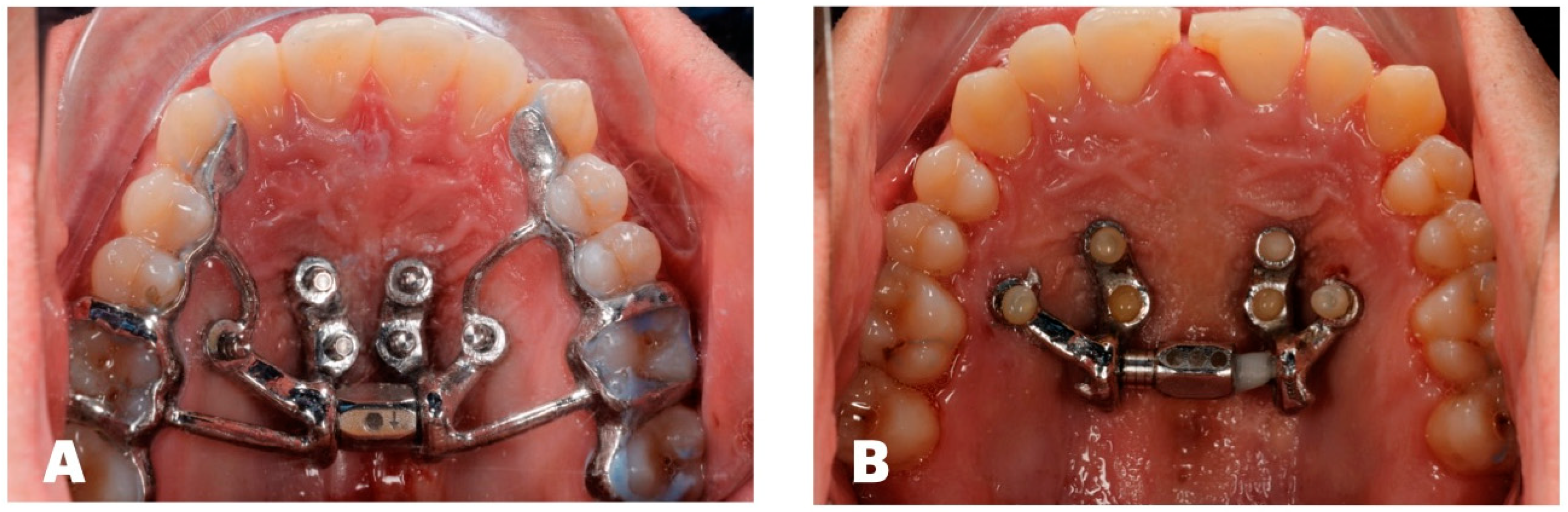 Dentistry 14 00024 g003 Dentistry 14 00024 g003