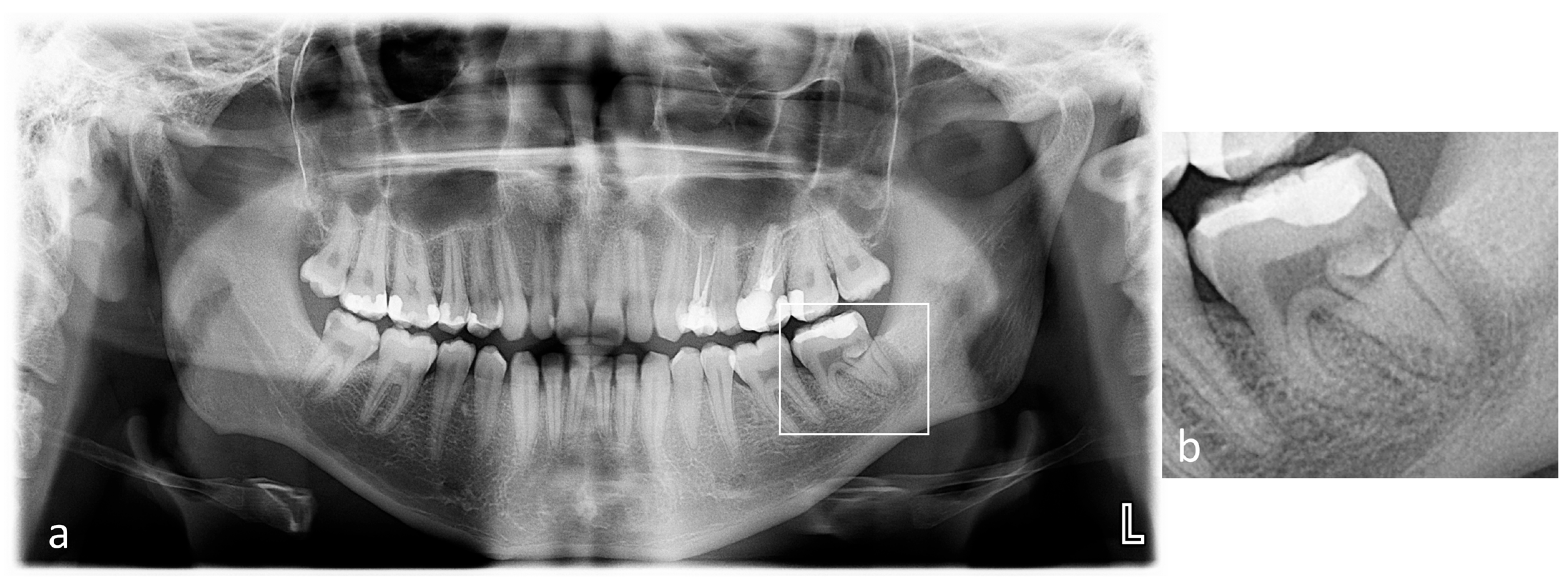 Dentistry 14 00027 g002 Dentistry 14 00027 g002