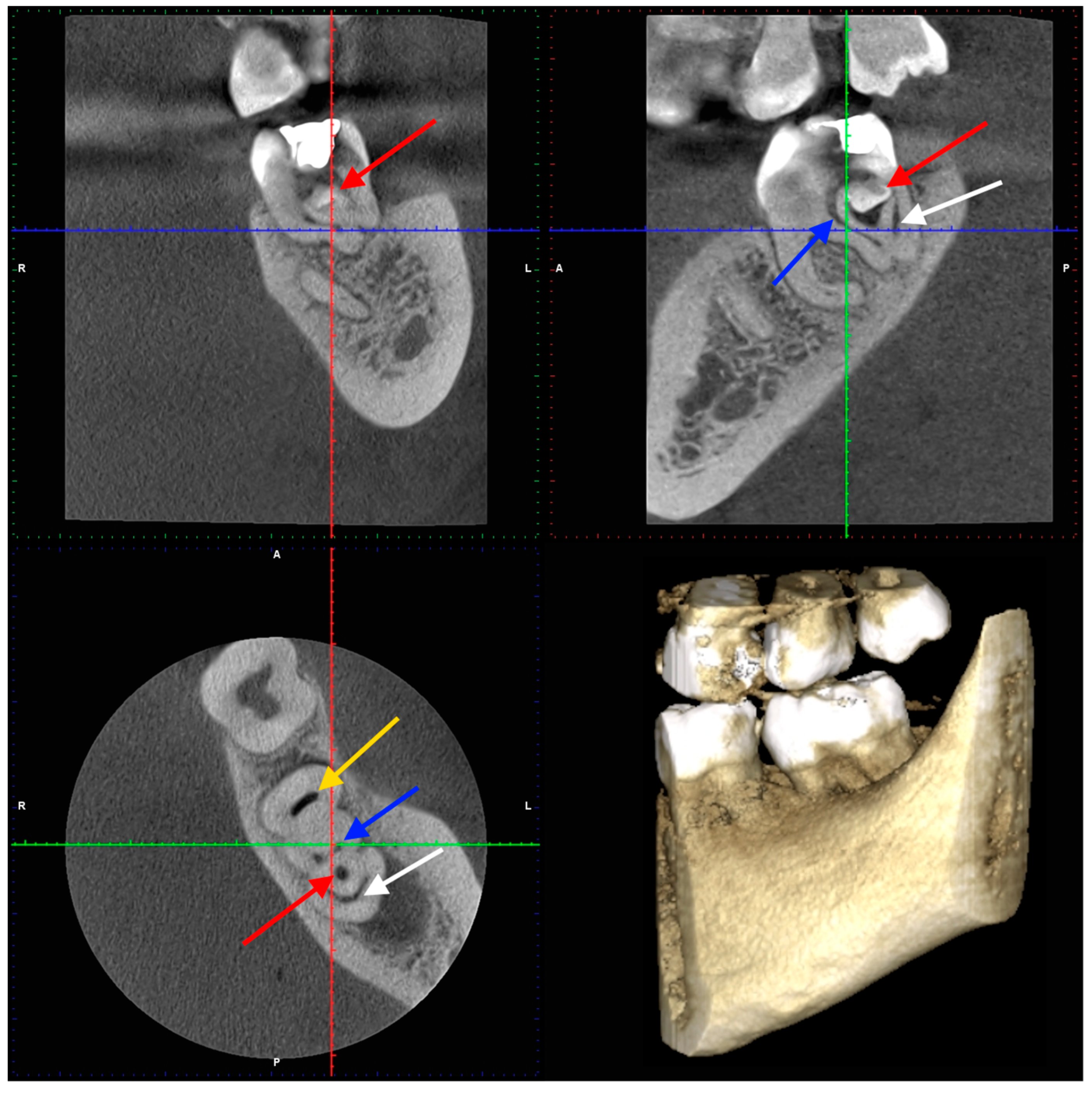 Dentistry 14 00027 g004 Dentistry 14 00027 g004