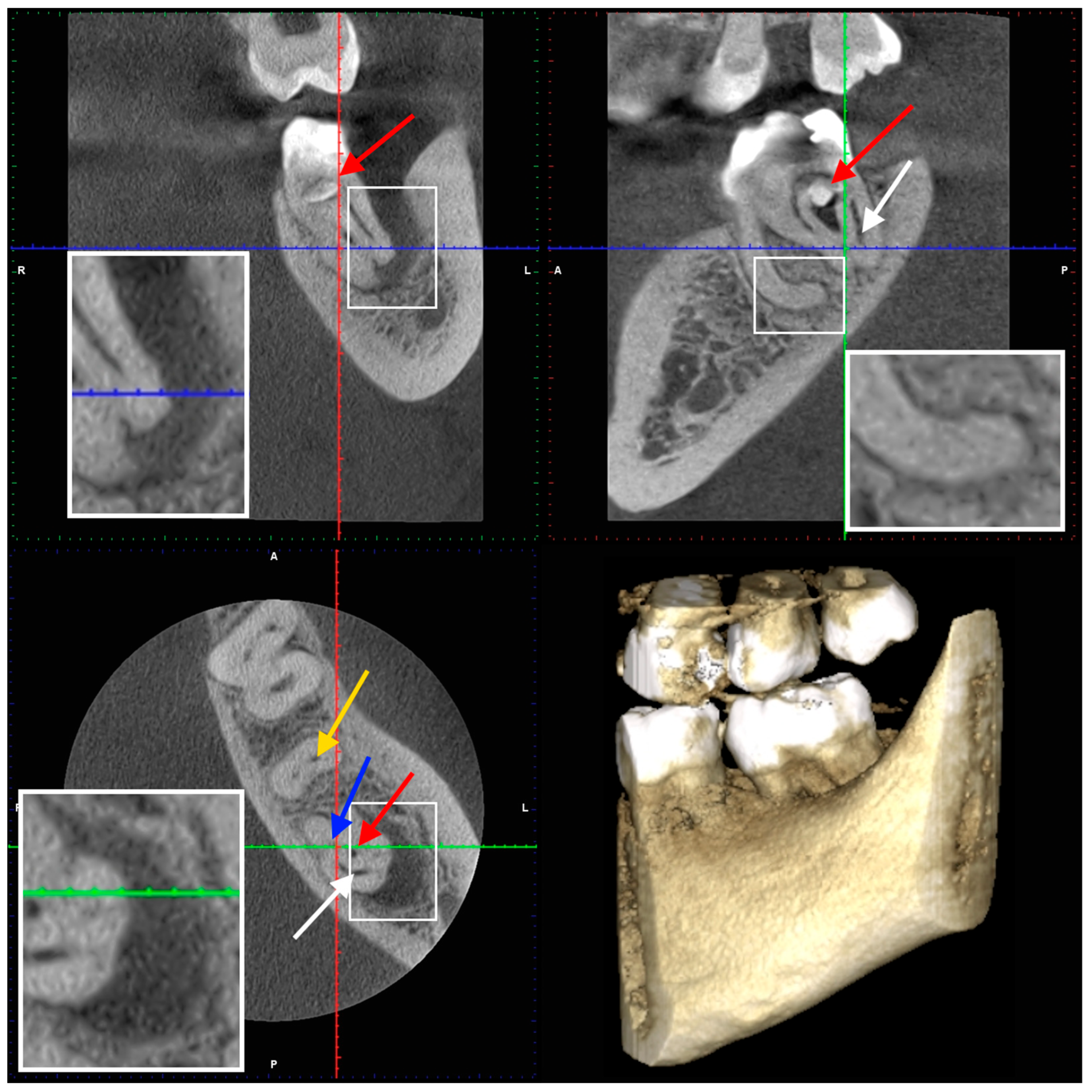Dentistry 14 00027 g005 Dentistry 14 00027 g005