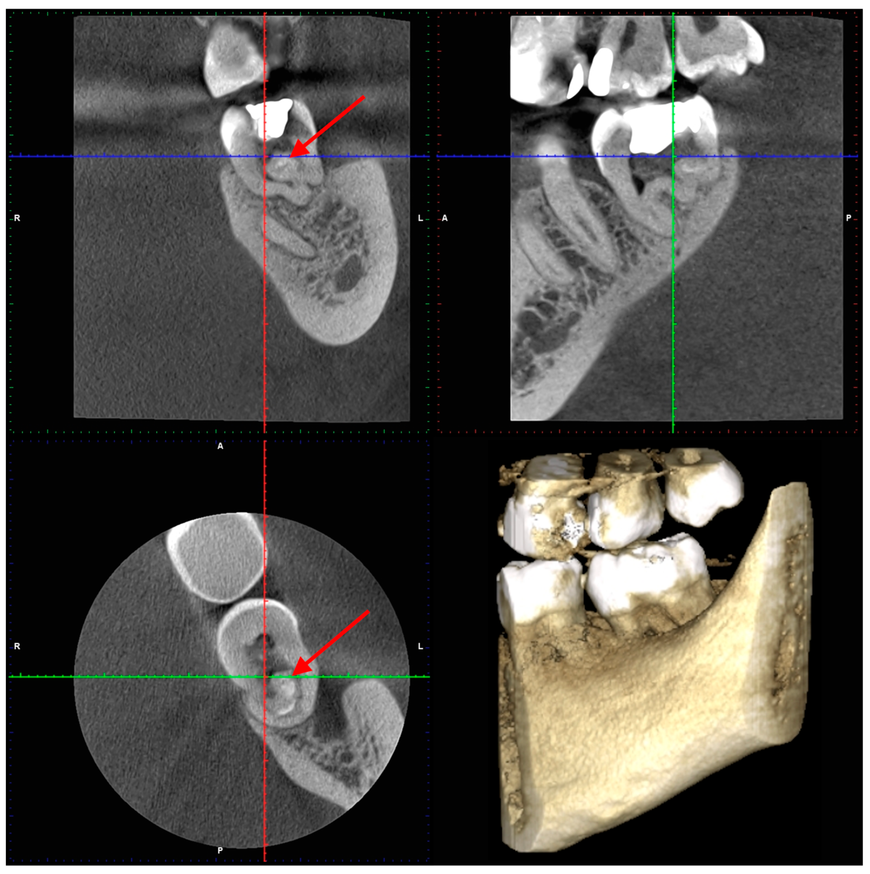 Dentistry 14 00027 g006 Dentistry 14 00027 g006