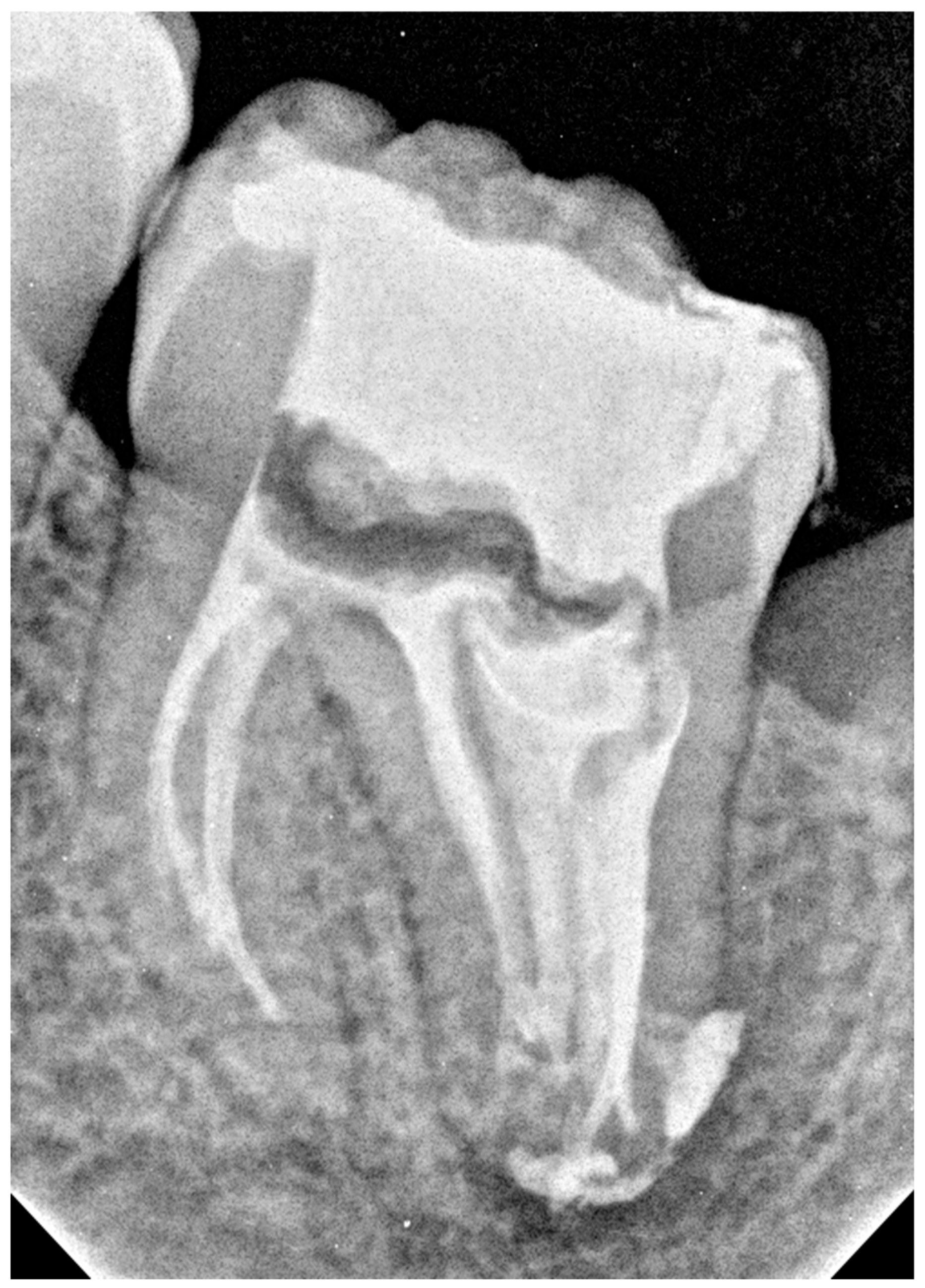 Dentistry 14 00027 g007 Dentistry 14 00027 g007