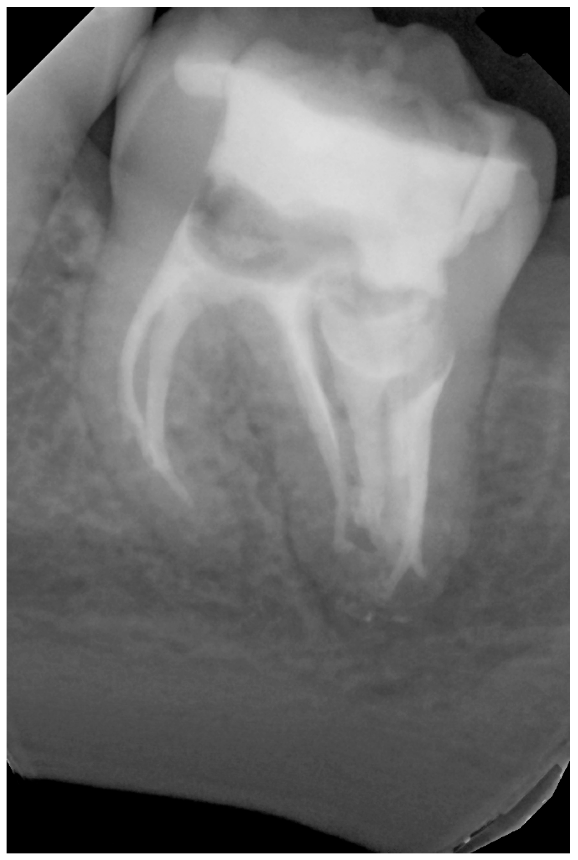 Dentistry 14 00027 g008 Dentistry 14 00027 g008