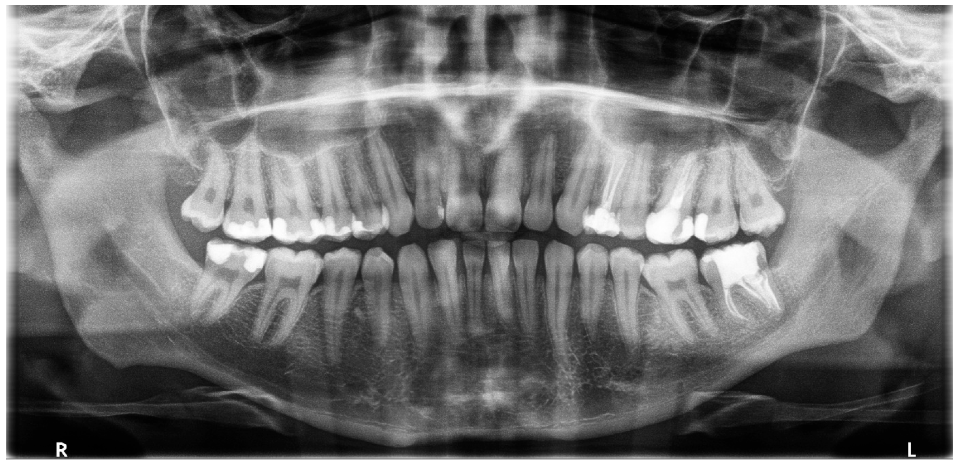 Dentistry 14 00027 g009 Dentistry 14 00027 g009