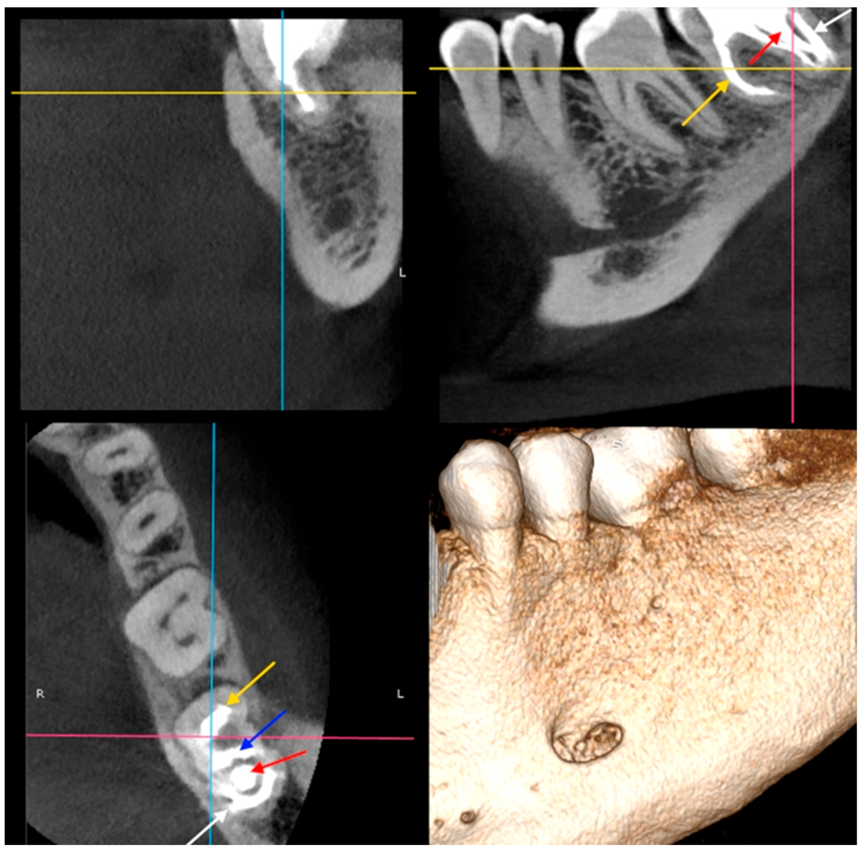 Dentistry 14 00027 g010 Dentistry 14 00027 g010