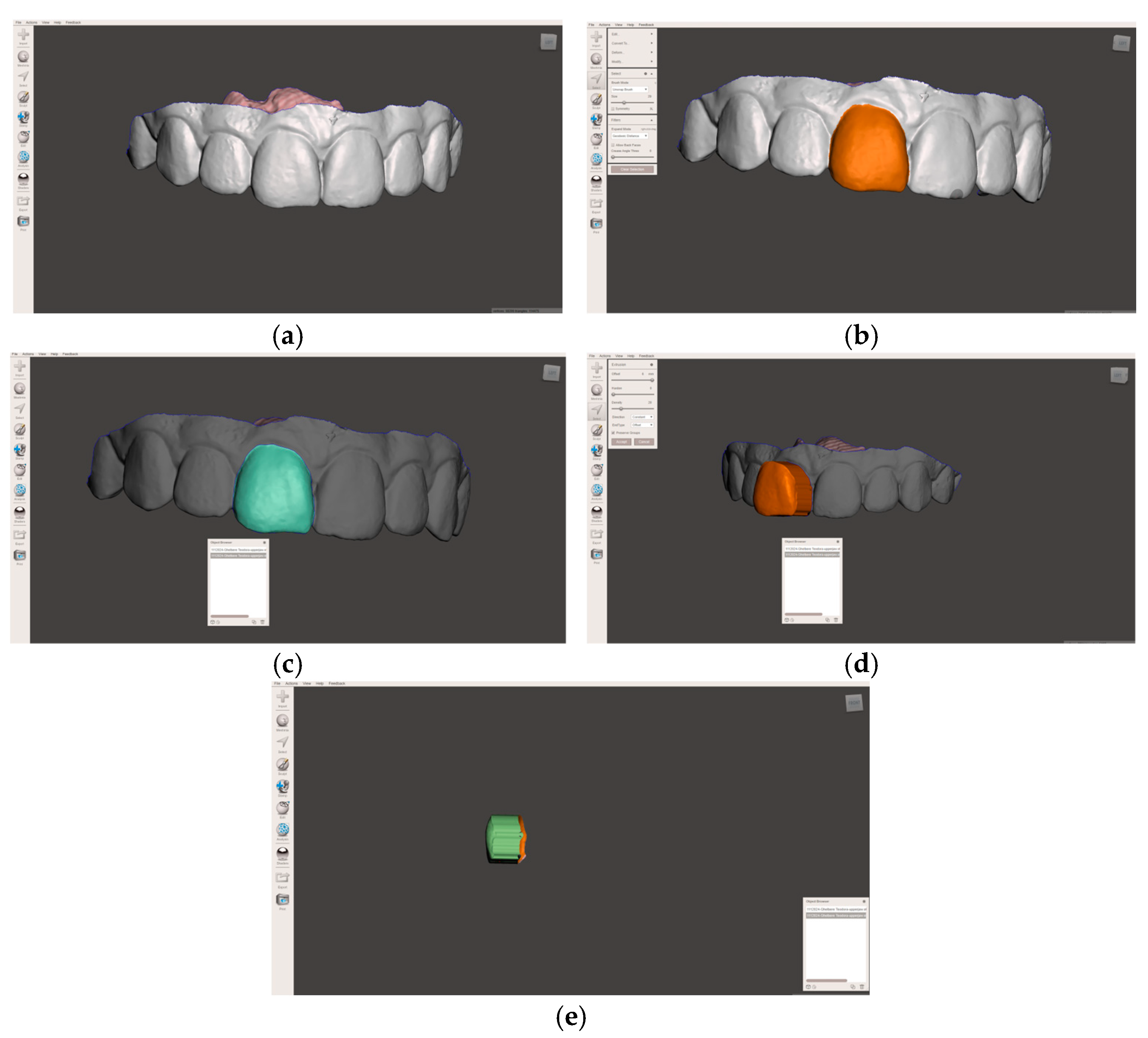 Dentistry 14 00035 g001 Dentistry 14 00035 g001