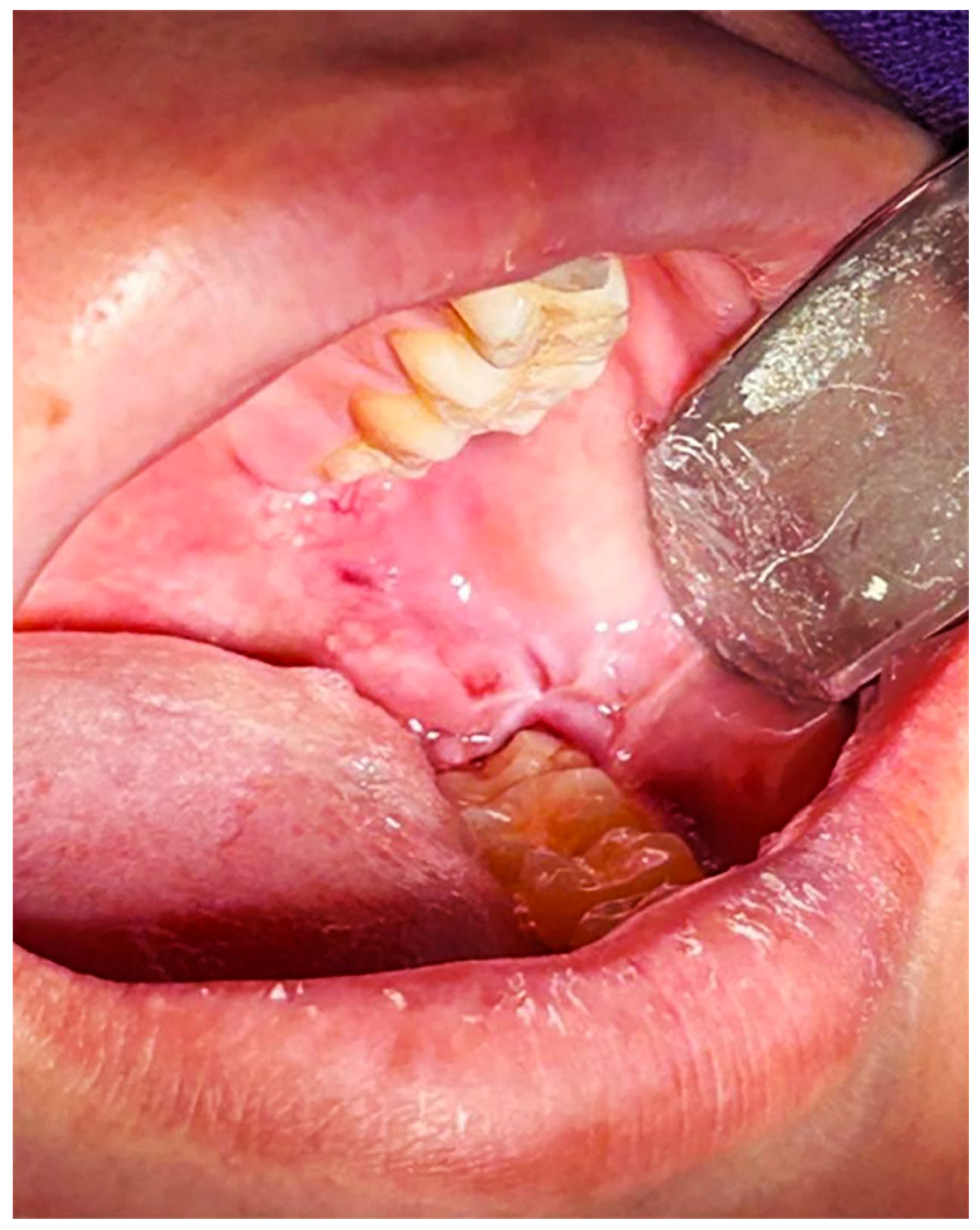 Dentistry 14 00044 g001 Dentistry 14 00044 g001