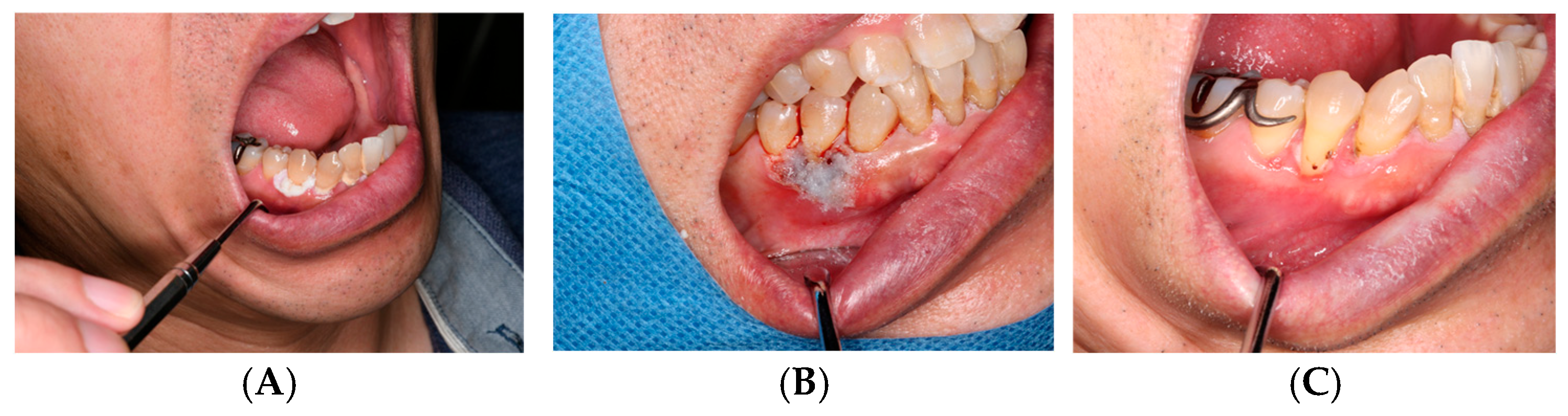 Dentistry 14 00073 g003