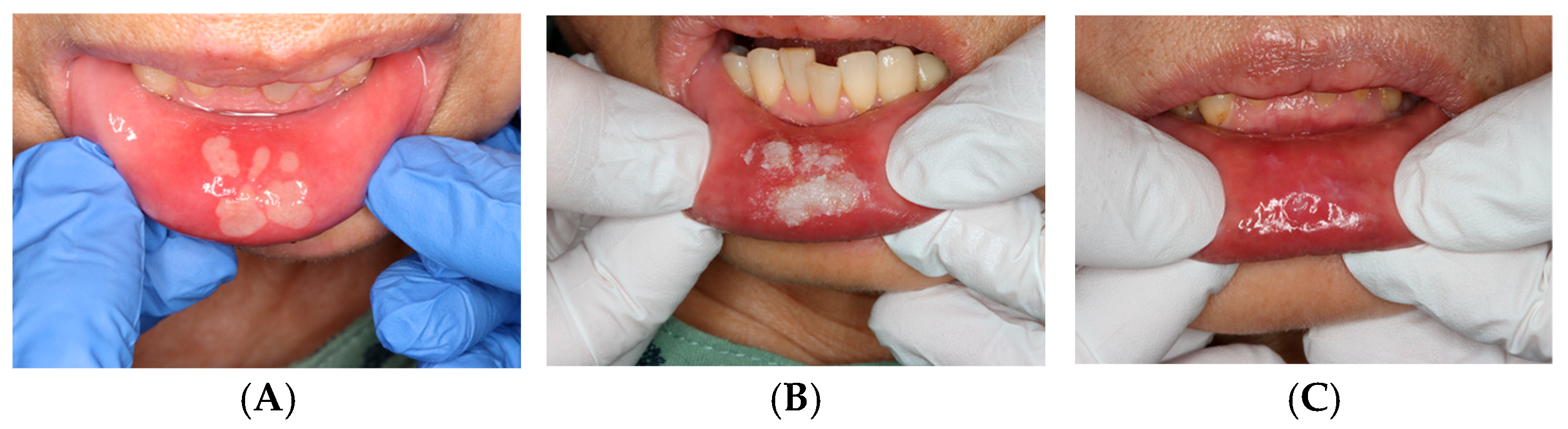 Dentistry 14 00073 g005