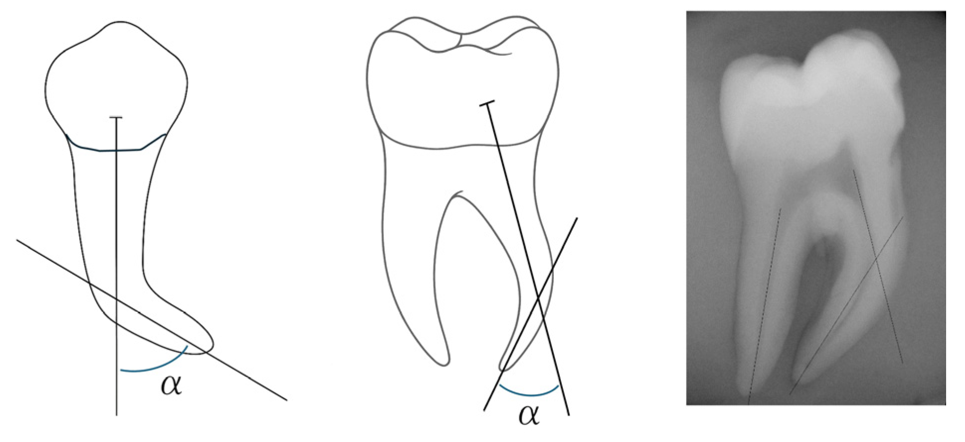 Dentistry 14 00092 g001 Dentistry 14 00092 g001