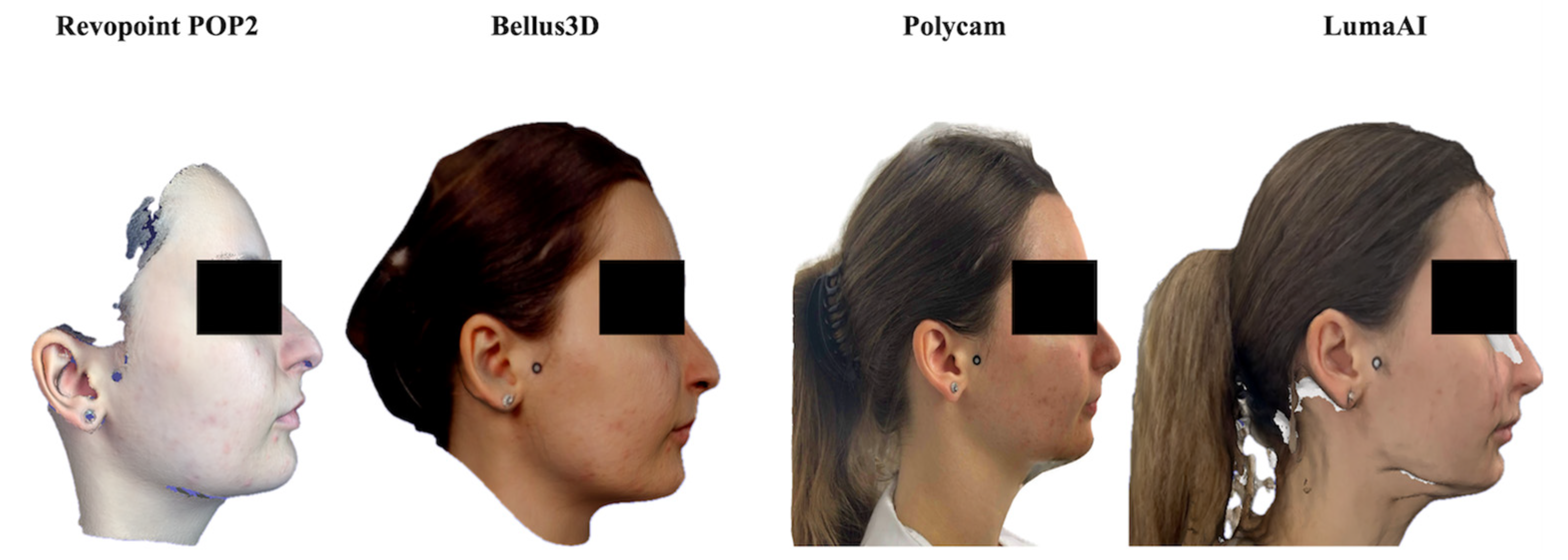 Dentistry 14 00113 g001 Dentistry 14 00113 g001