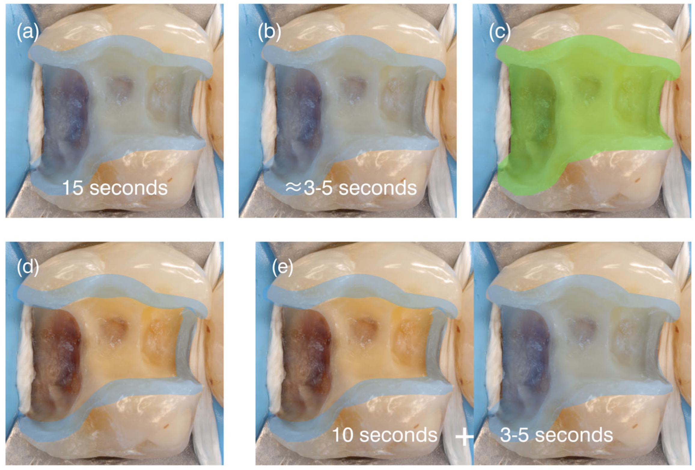 Dentistry 14 00119 g002 Dentistry 14 00119 g002