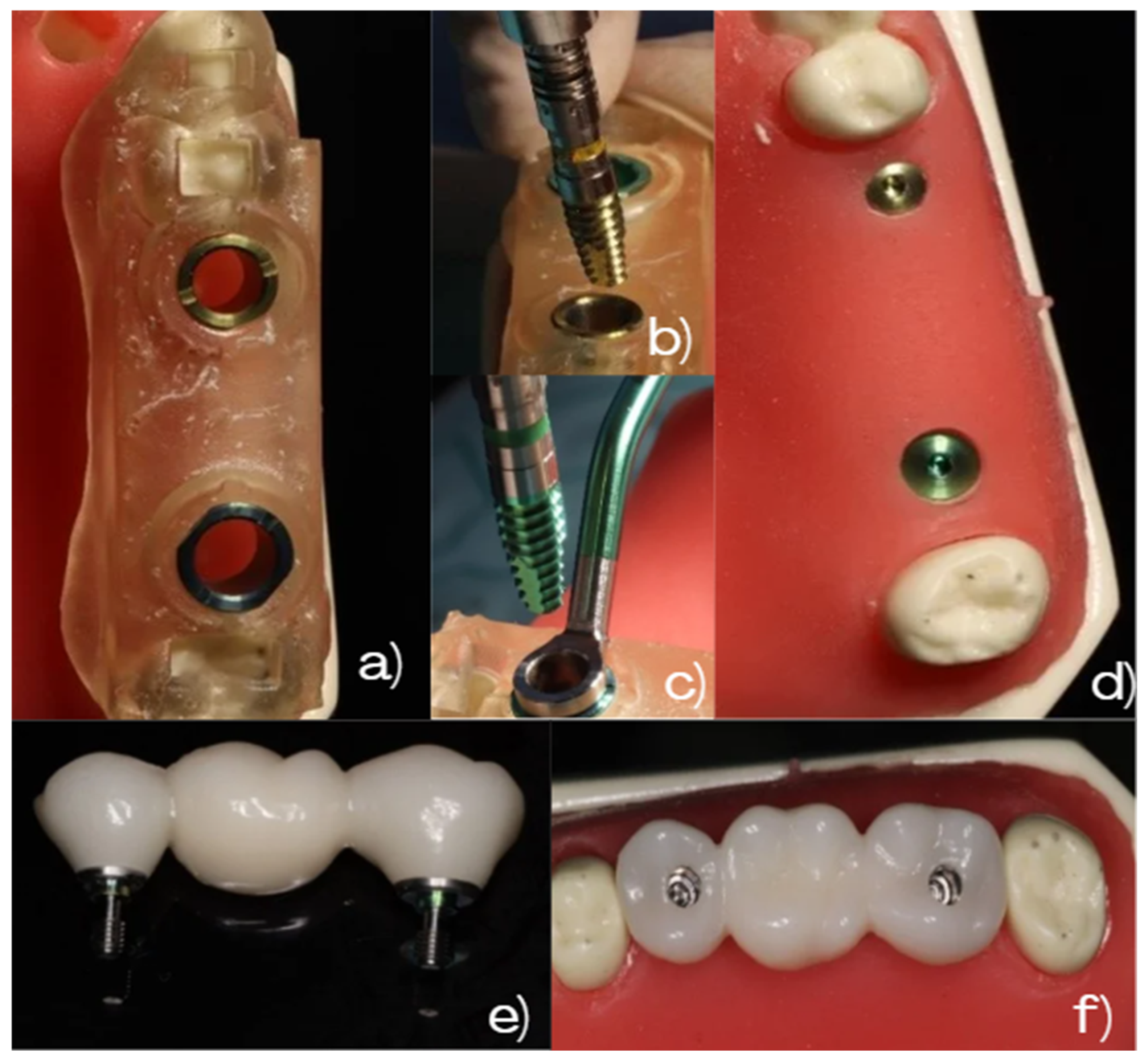 Dentistry 14 00120 g002 Dentistry 14 00120 g002