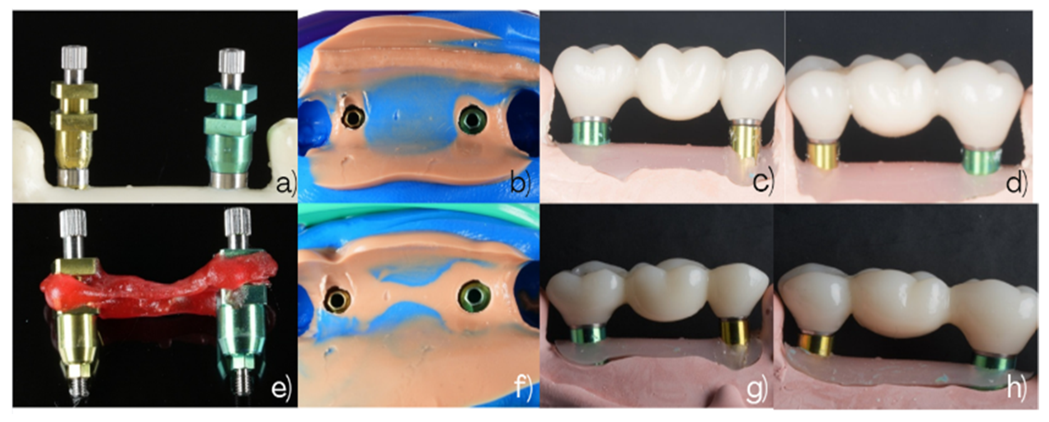 Dentistry 14 00120 g003 Dentistry 14 00120 g003
