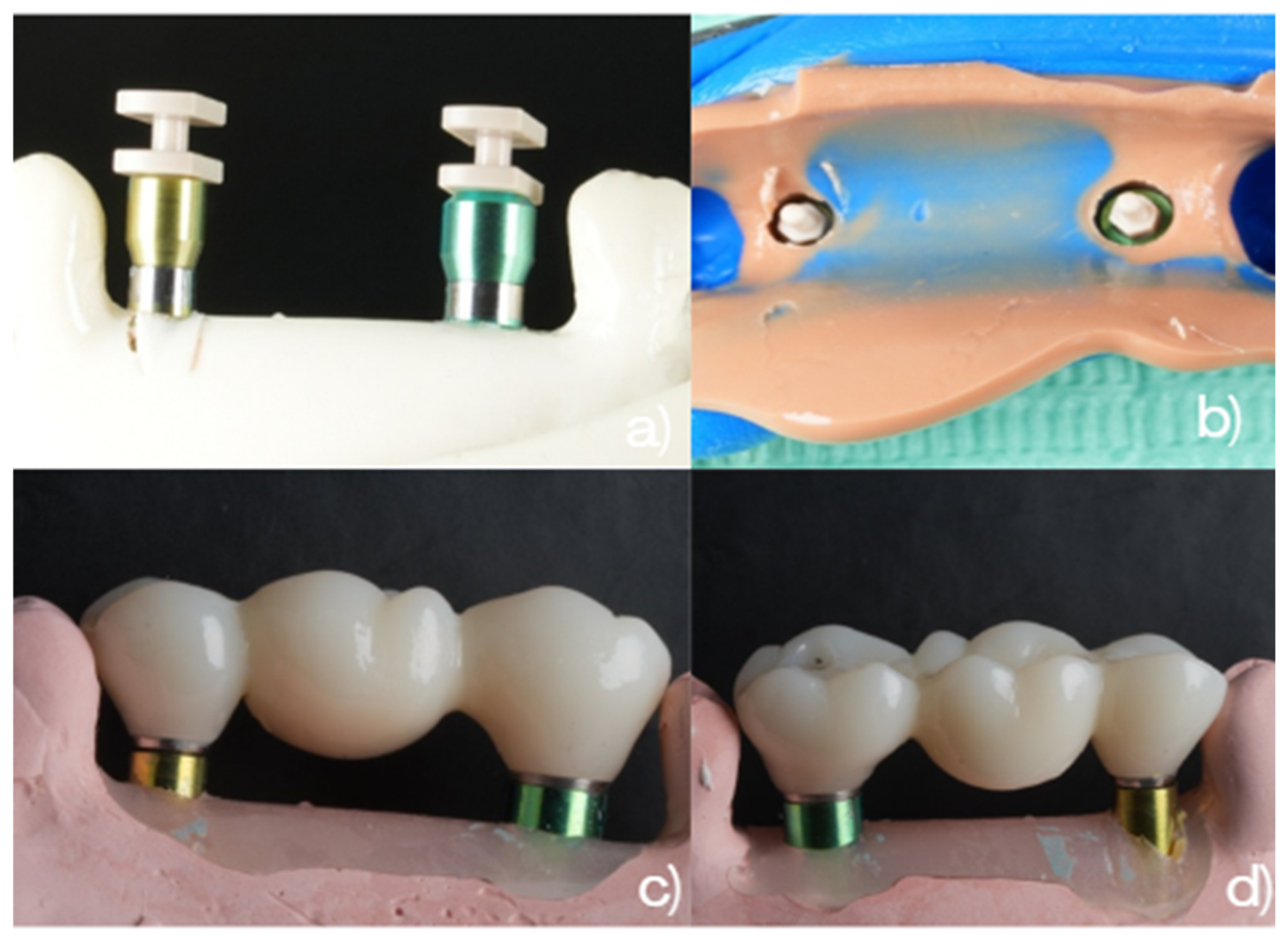 Dentistry 14 00120 g004 Dentistry 14 00120 g004