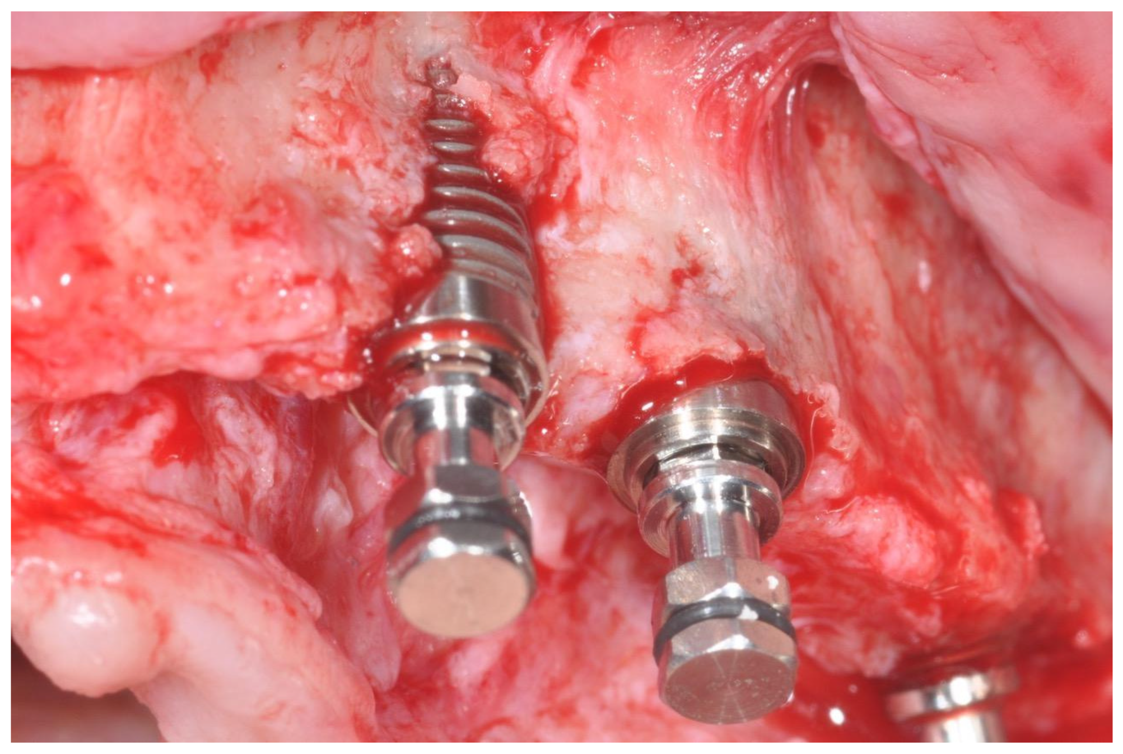 Dentistry 14 00121 g001