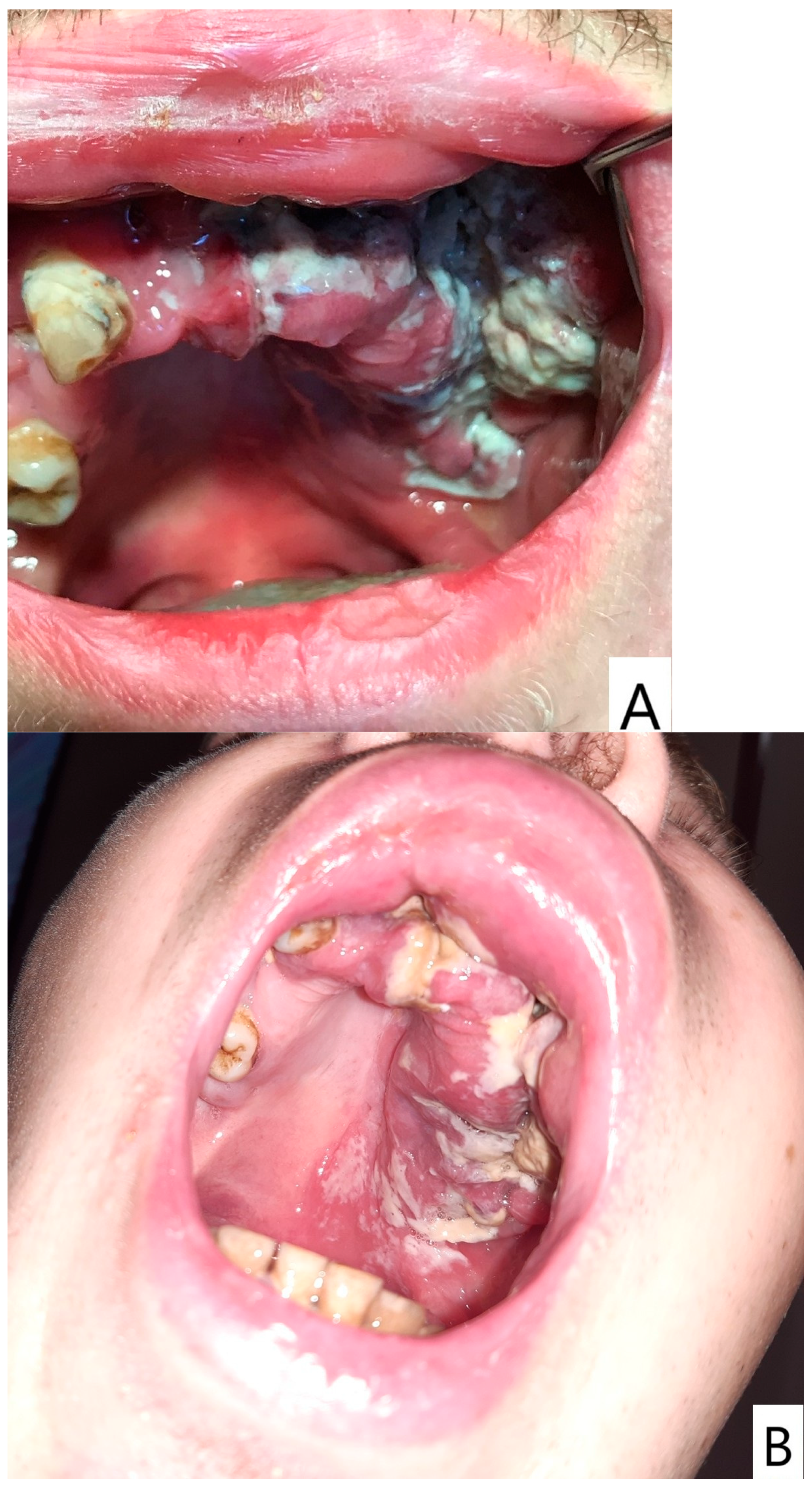 Dentistry 14 00129 g001 Dentistry 14 00129 g001