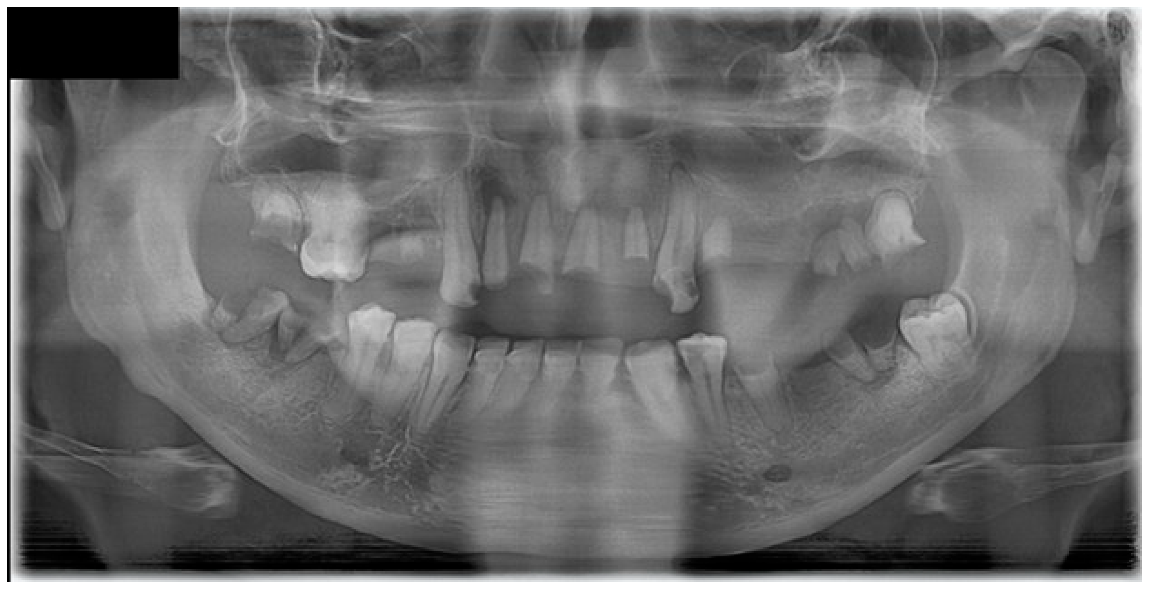 Dentistry 14 00129 g002 Dentistry 14 00129 g002