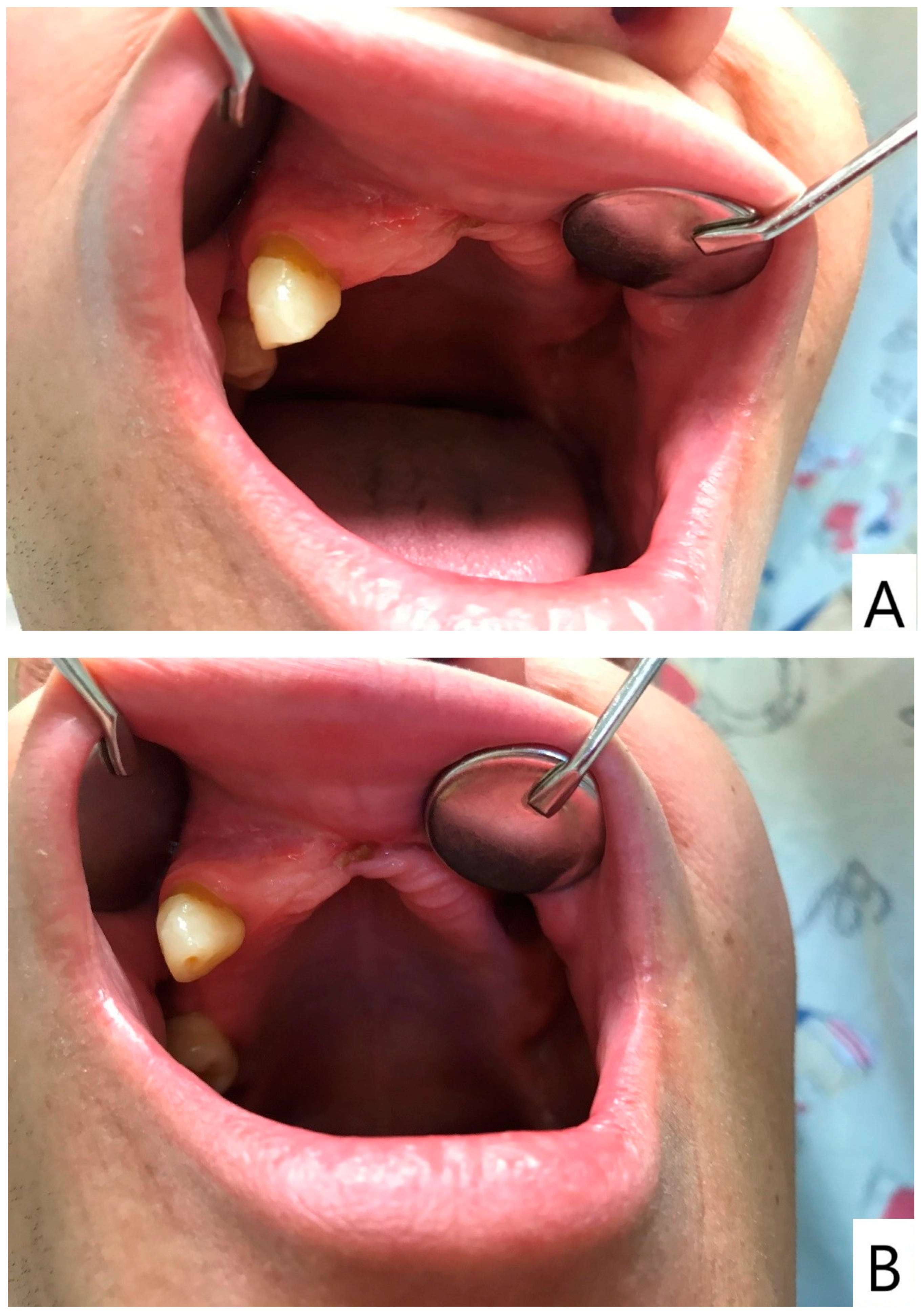 Dentistry 14 00129 g005 Dentistry 14 00129 g005