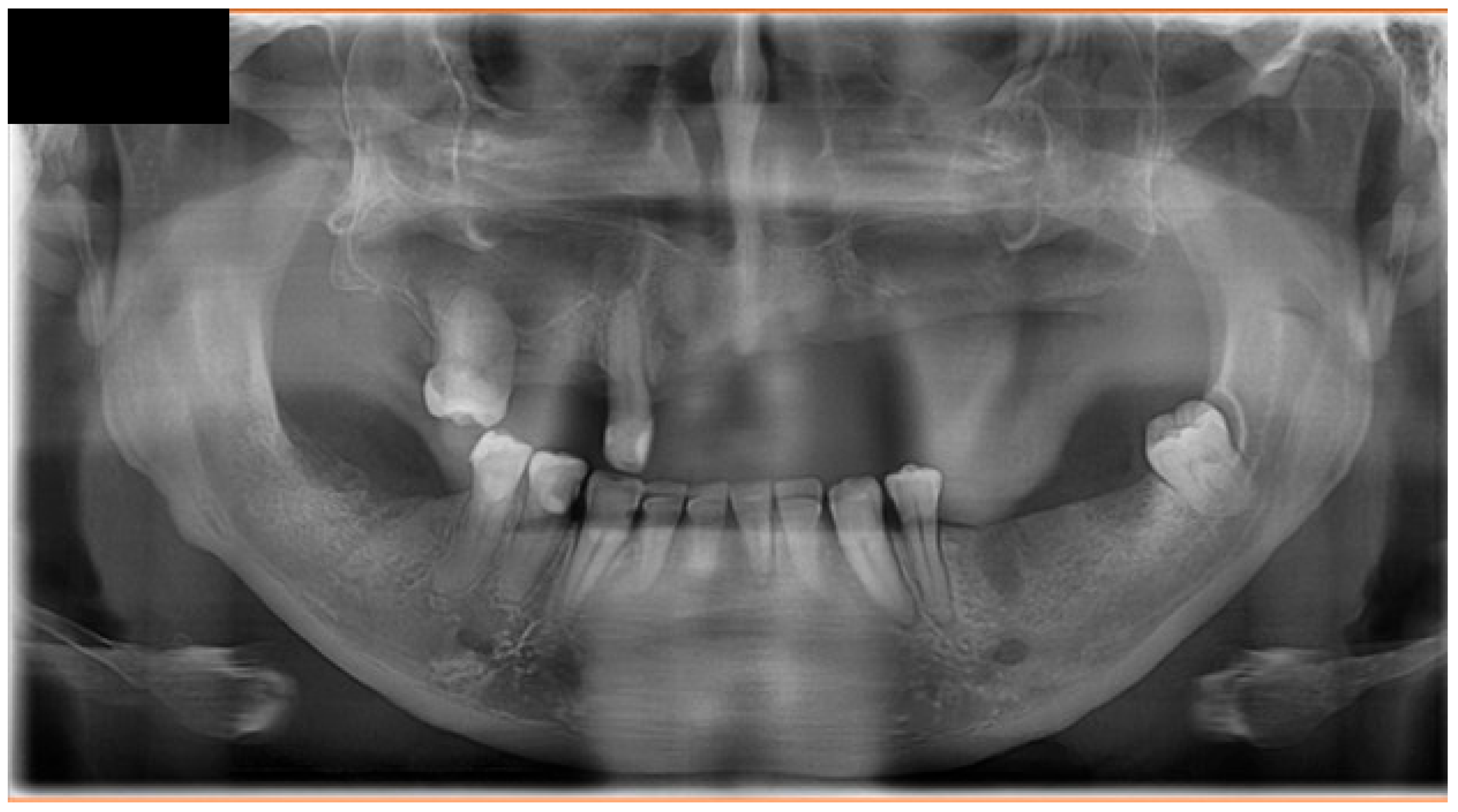 Dentistry 14 00129 g006 Dentistry 14 00129 g006