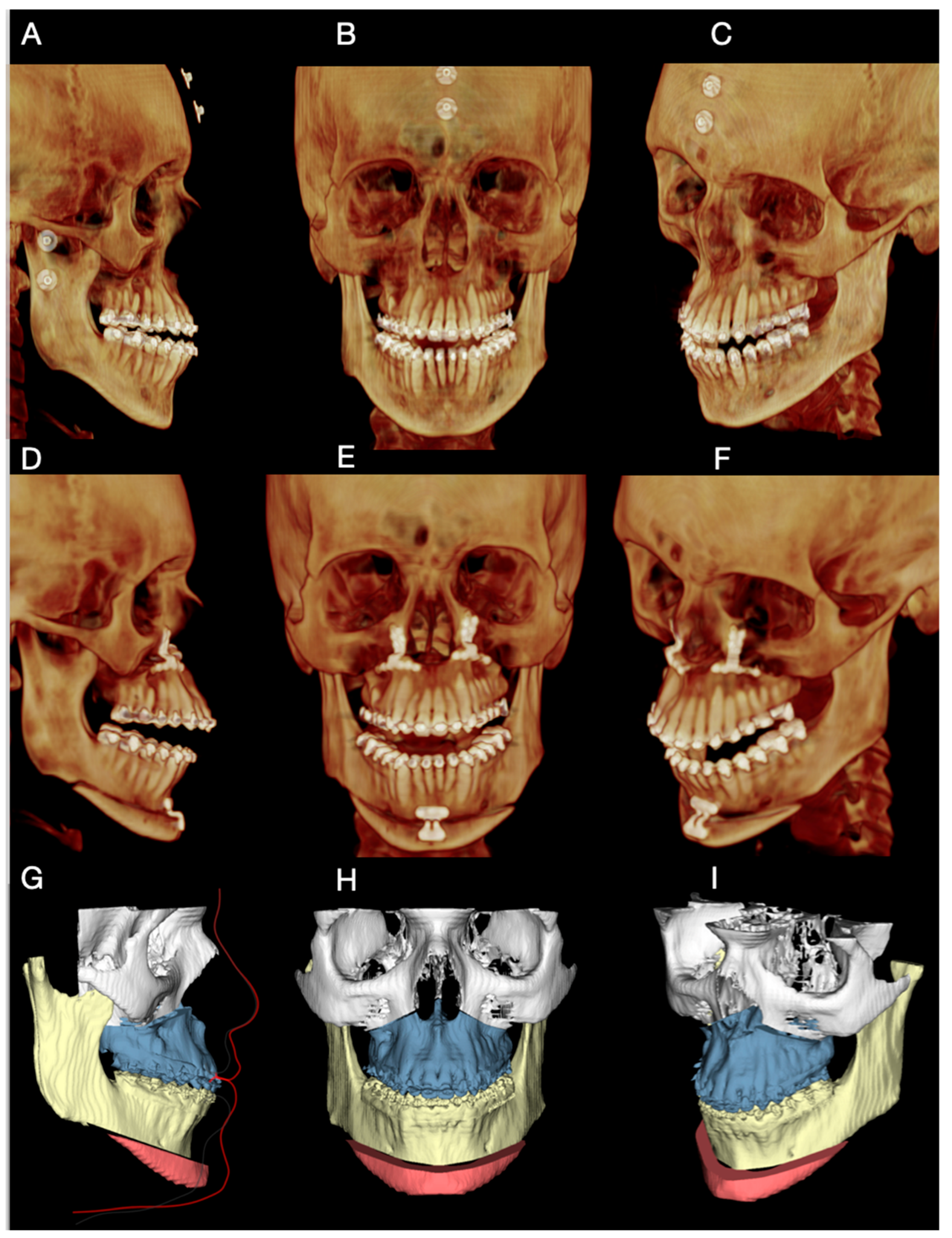 Dentistry 14 00135 g002 Dentistry 14 00135 g002