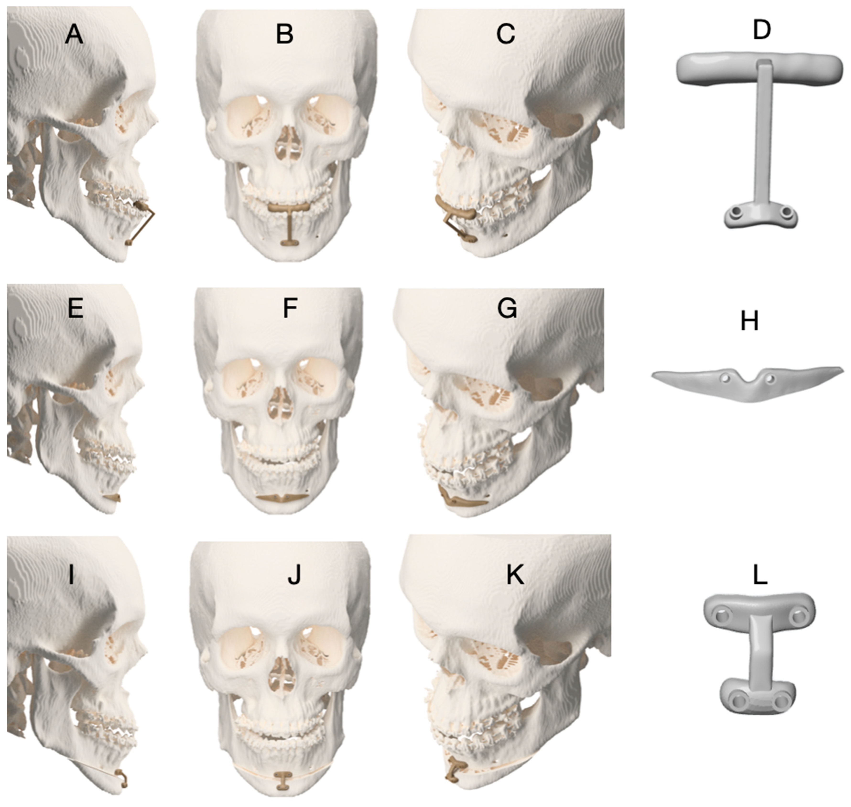 Dentistry 14 00135 g003 Dentistry 14 00135 g003